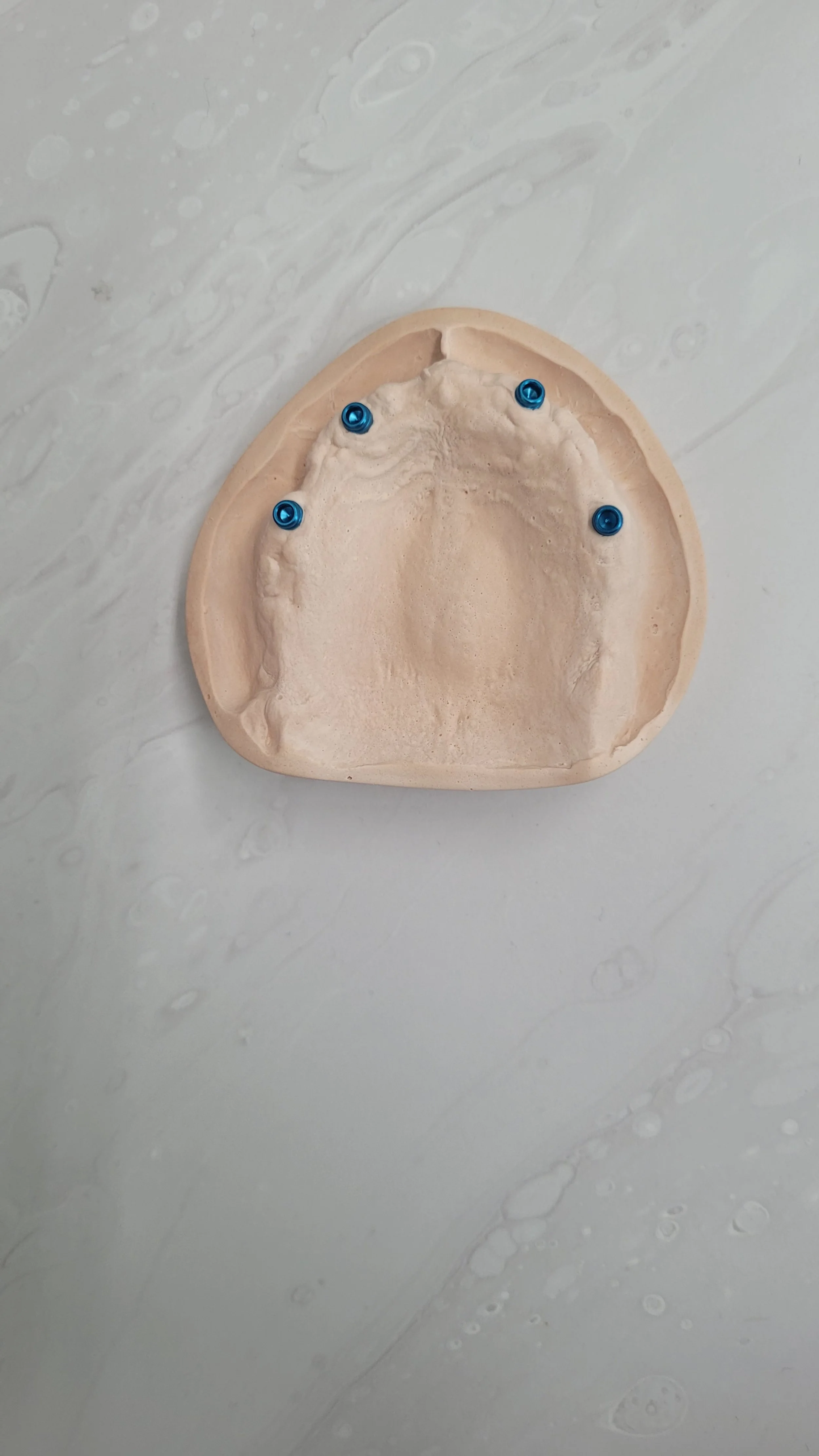 Implant Denture 10.jpg