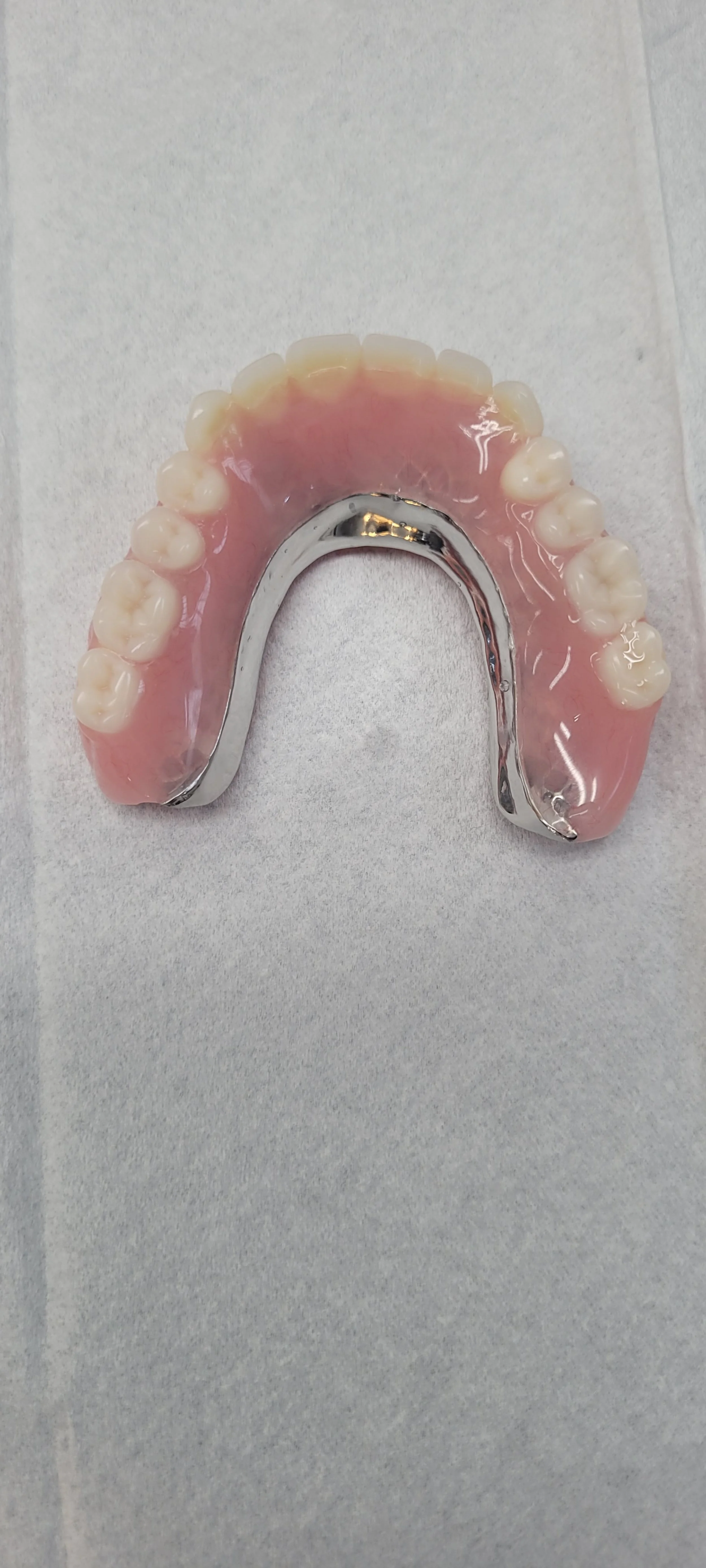 Implant Denture 13.jpg