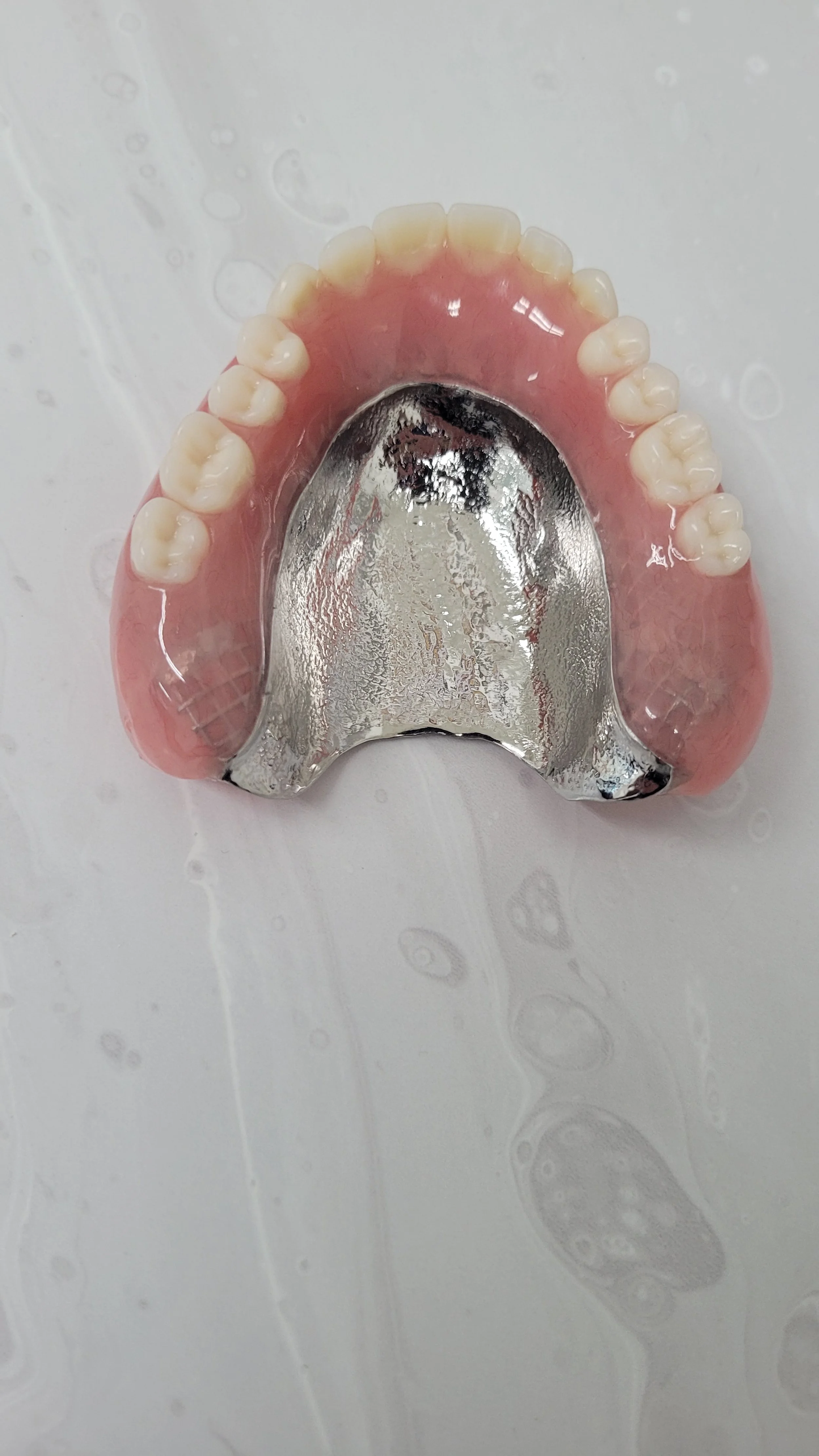 Reinforced Denture 7.jpg