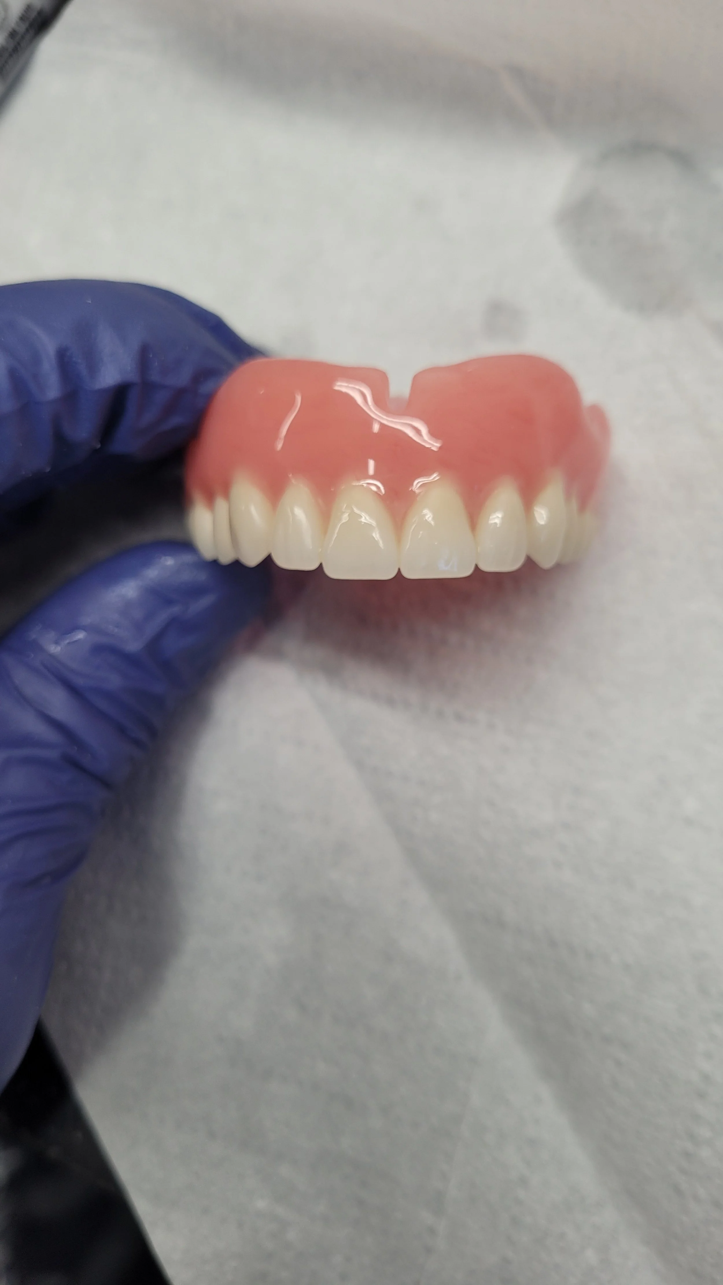 Complete Denture 4.jpg