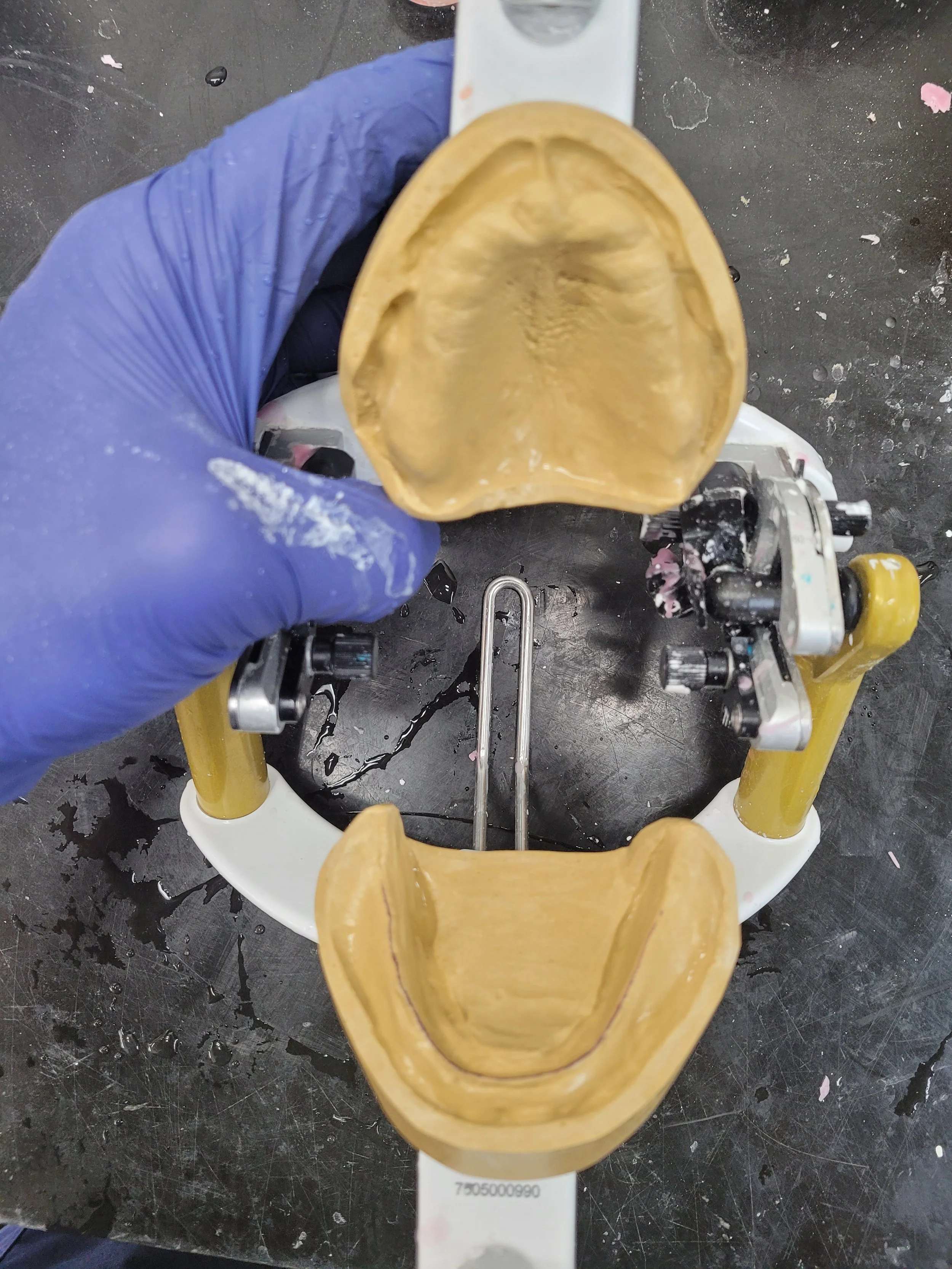 Complete Denture 6.jpg