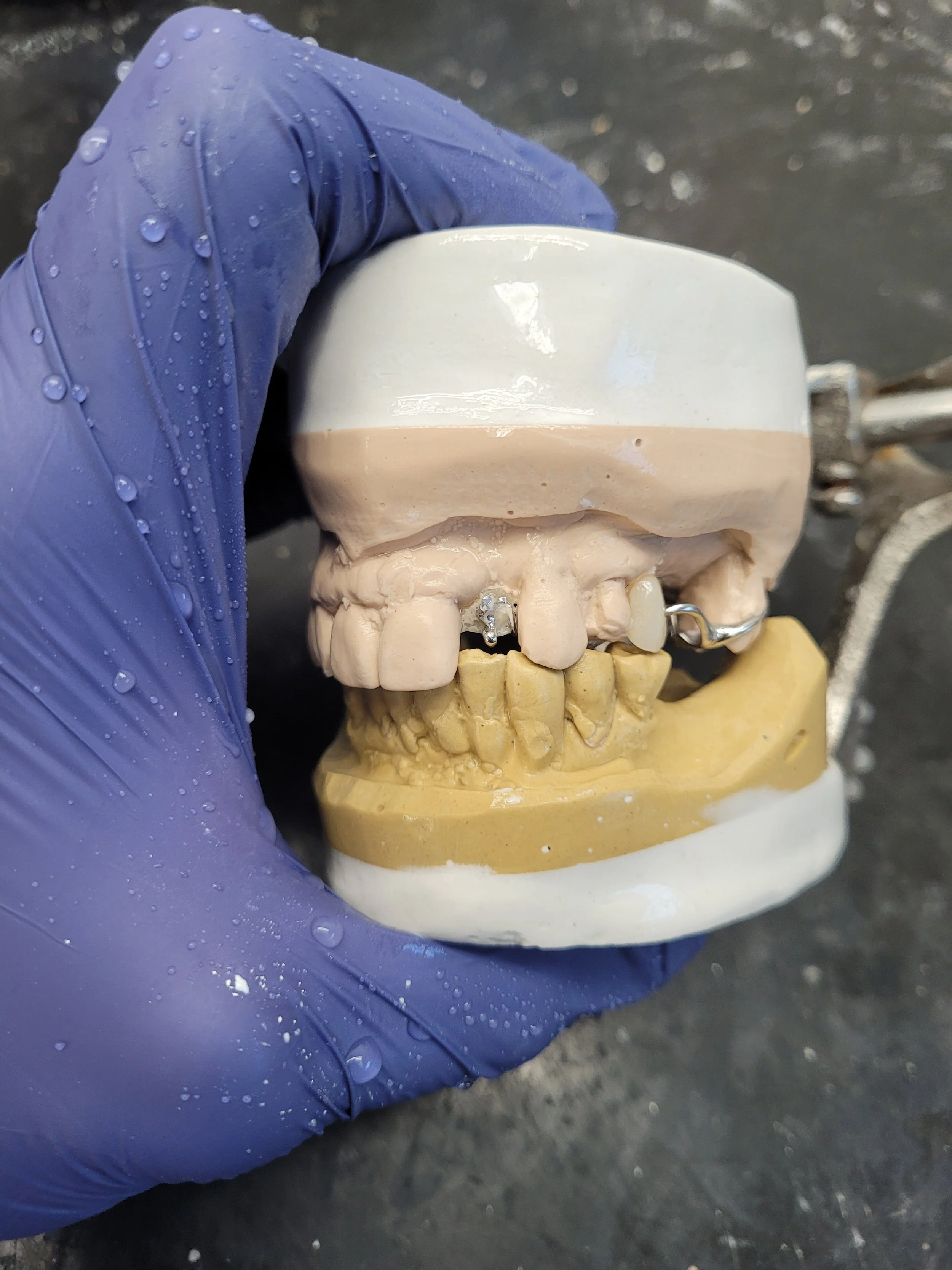 Partial Denture 1.jpg