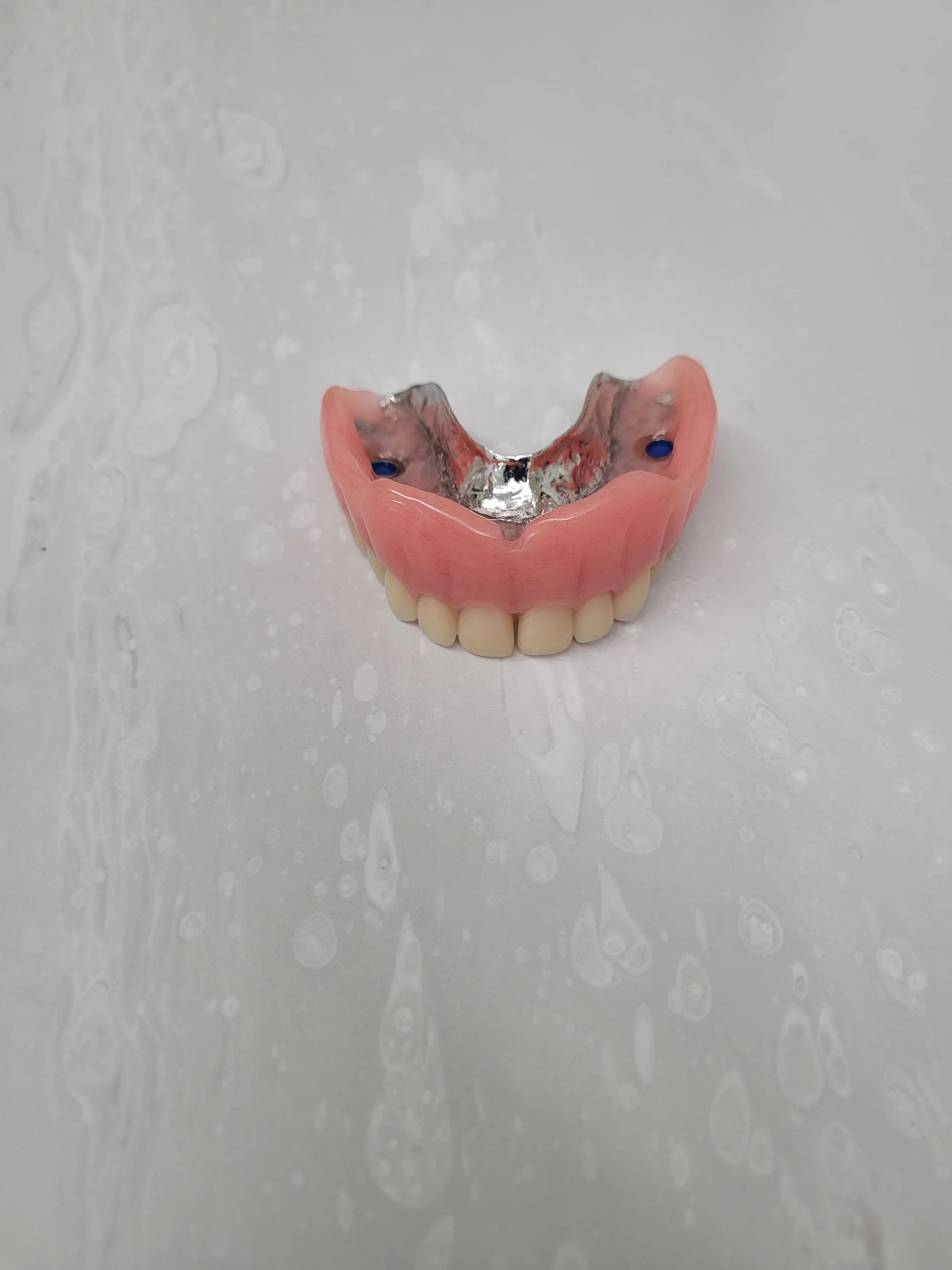 Implant Denture 8.jpg