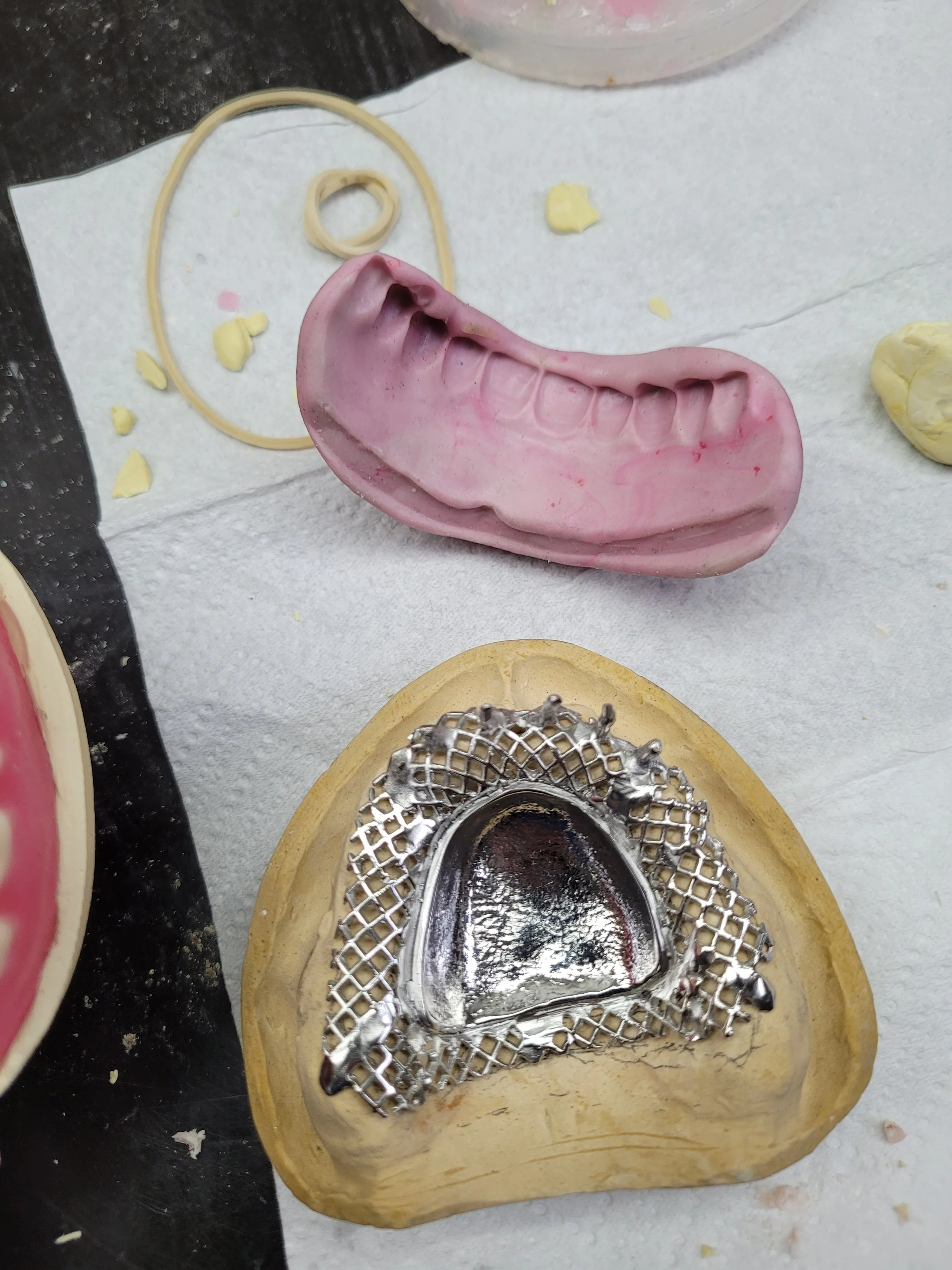 Reinforced Denture 1.jpg