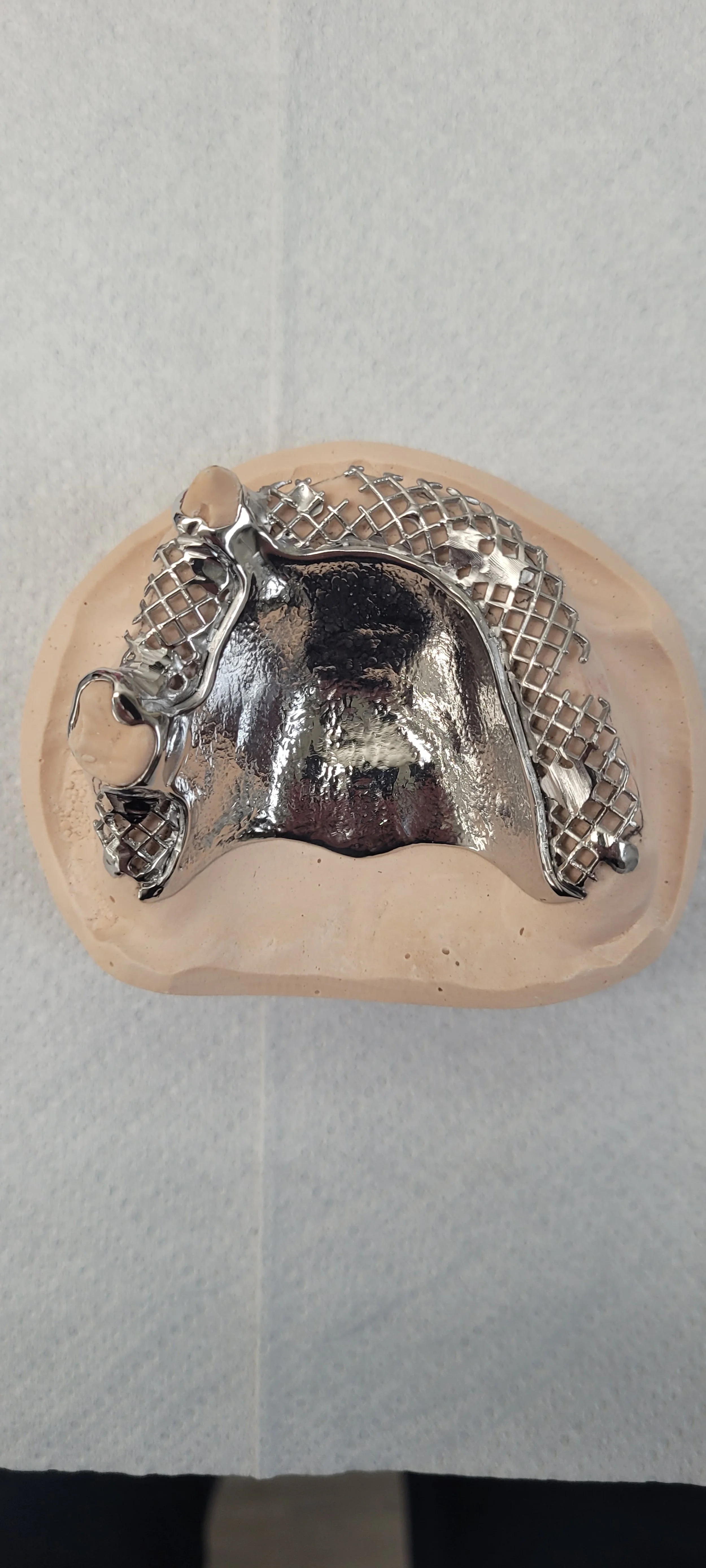 Partial Denture 3.jpg