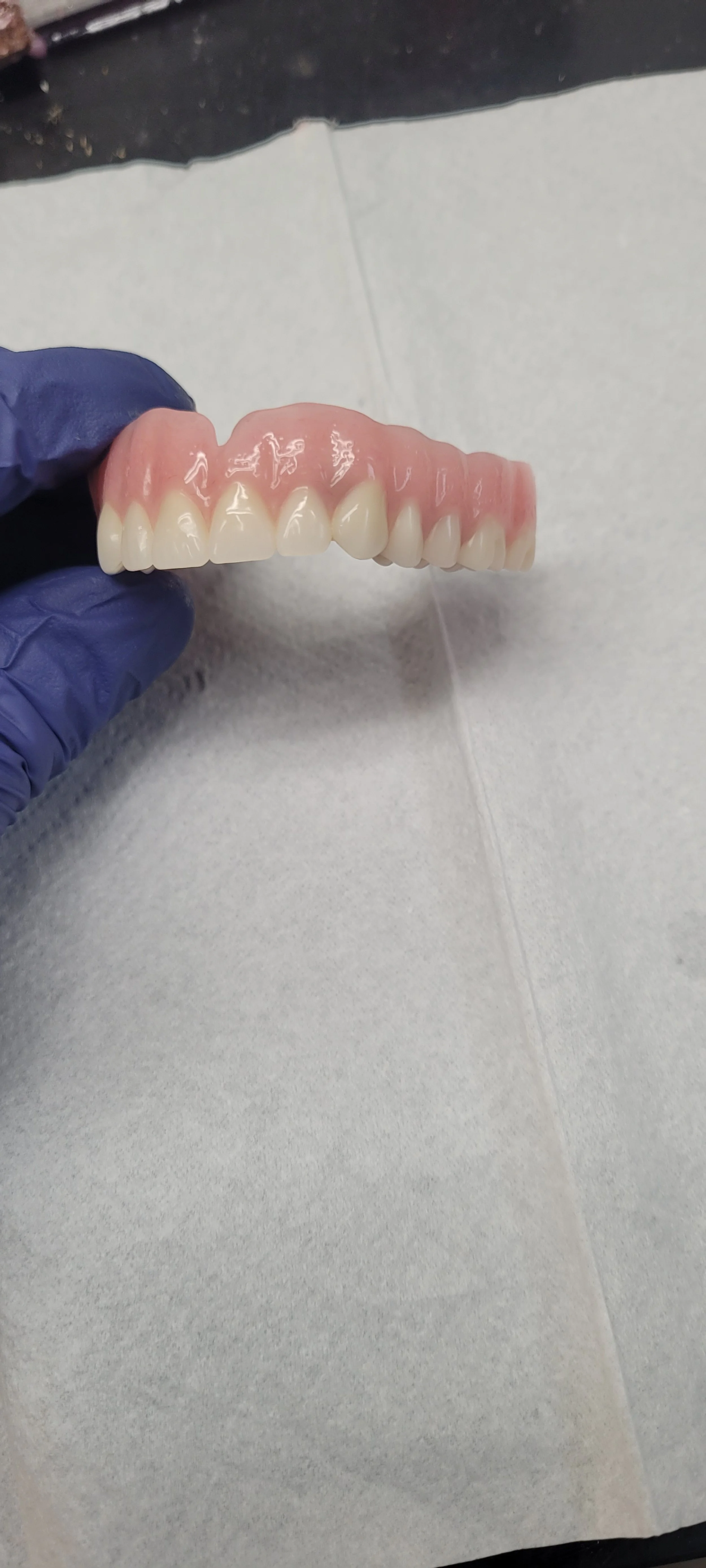 Implant Denture 12.jpg