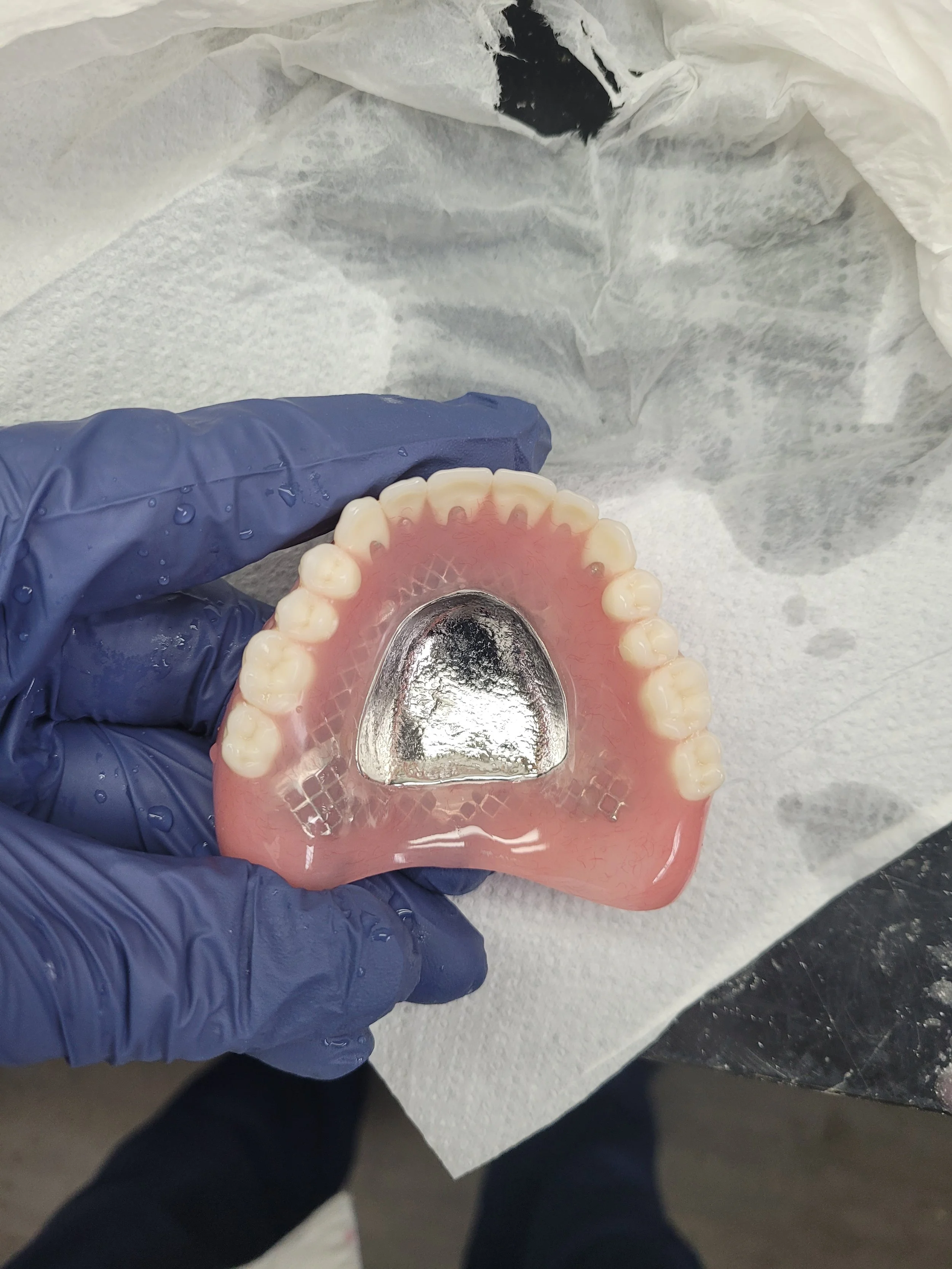 Reinforced Denture 2.jpg