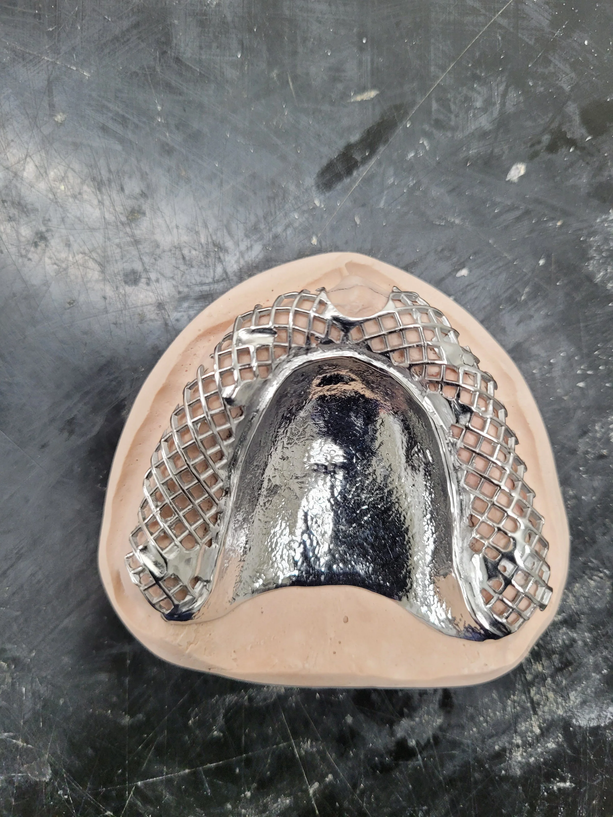 Reinforced Denture 4.jpg