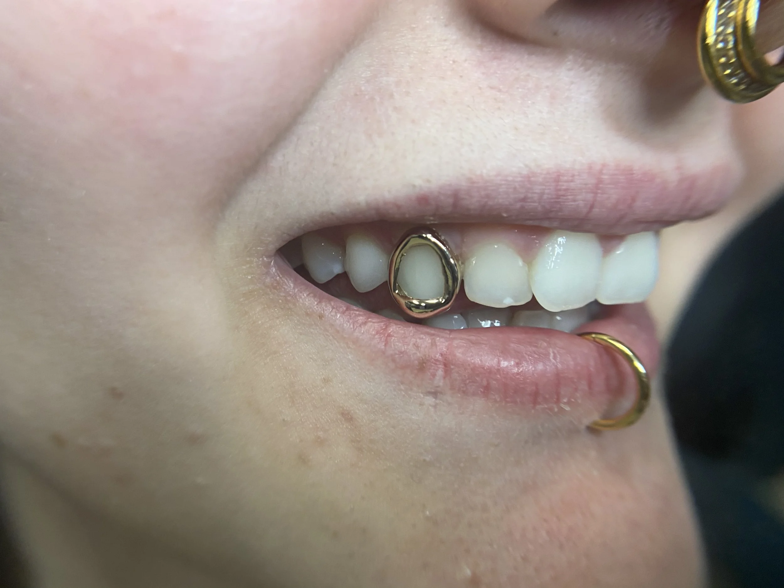 Femme Gemz Custom Removable Grillz Training — Femme Gemz