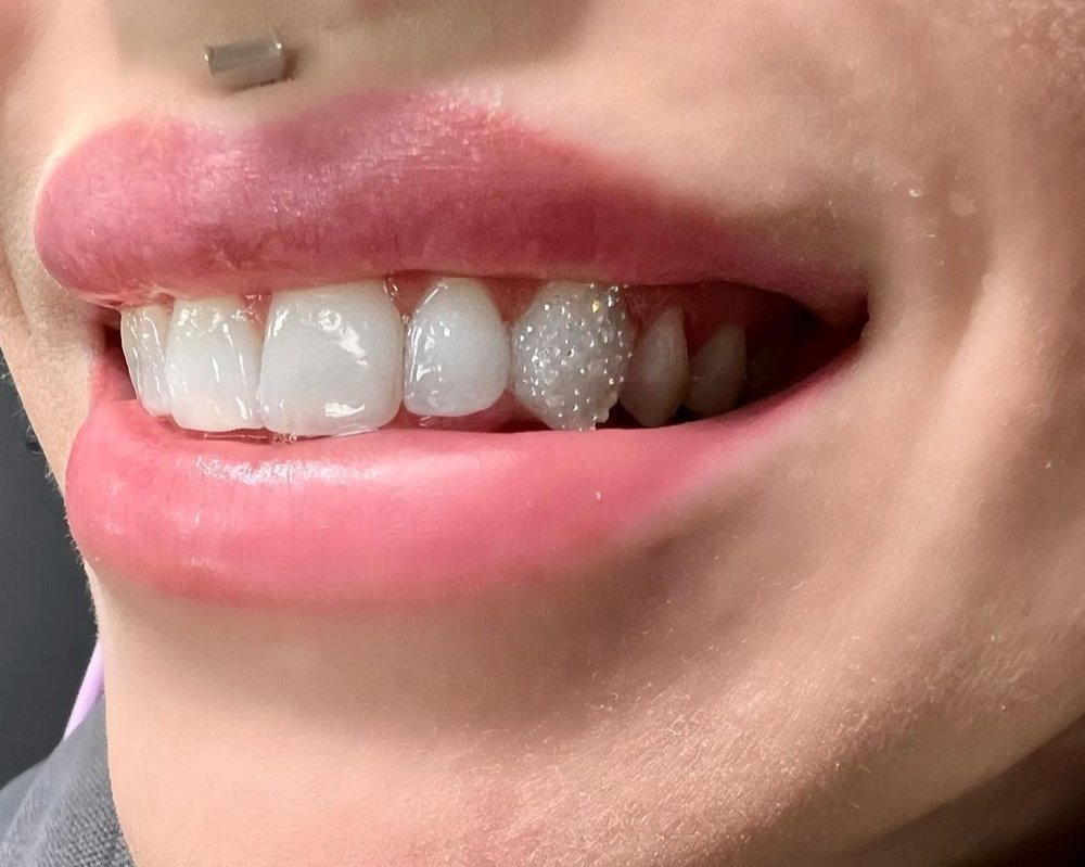 Tooth Gem Training (Course Only) – BeDazzled Smilez