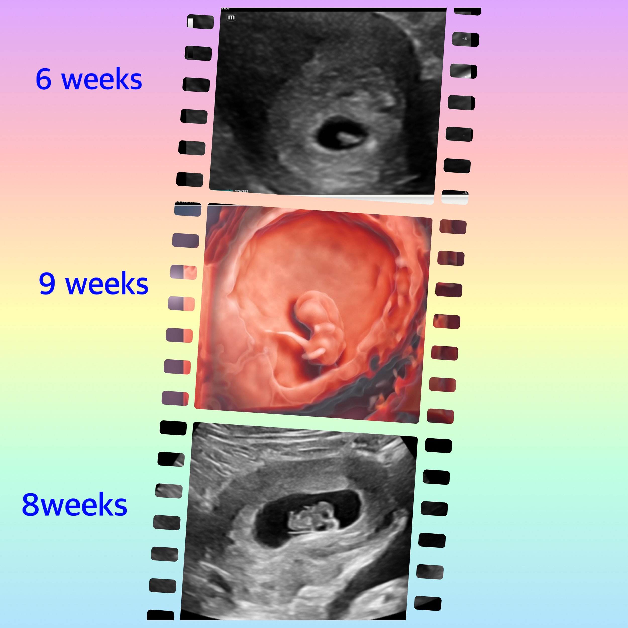 3D 4D 5D HD Baby Ultrasound Imaging Gender Ultrasound Sonogram Bebe 3d-4d-5d-hd-baby-ultrasound-imaging-gender-ultrasound-sonogram-bebe