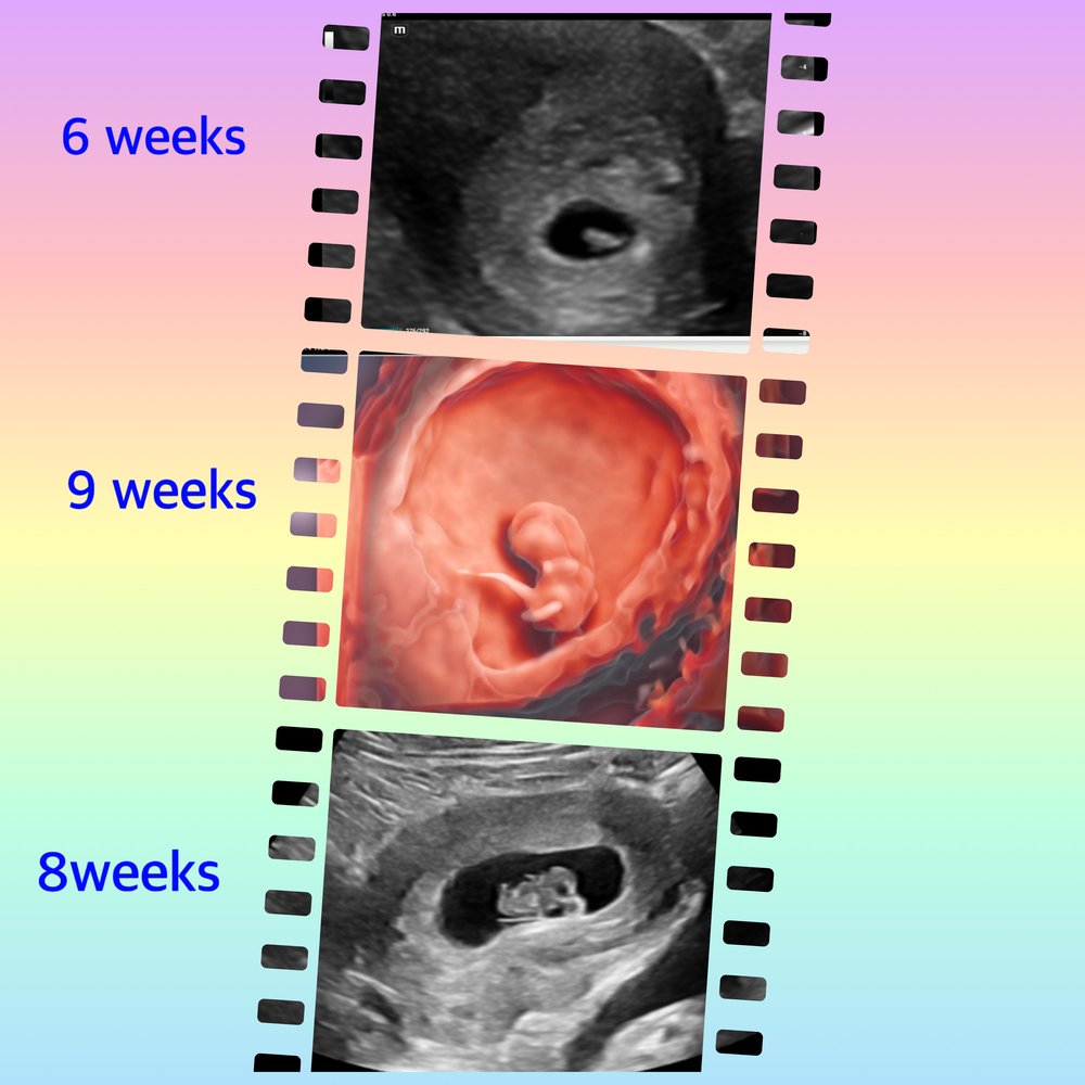 Ultrasound 3d 4d 5d hd baby ultrasound imaging gender ultrasound
