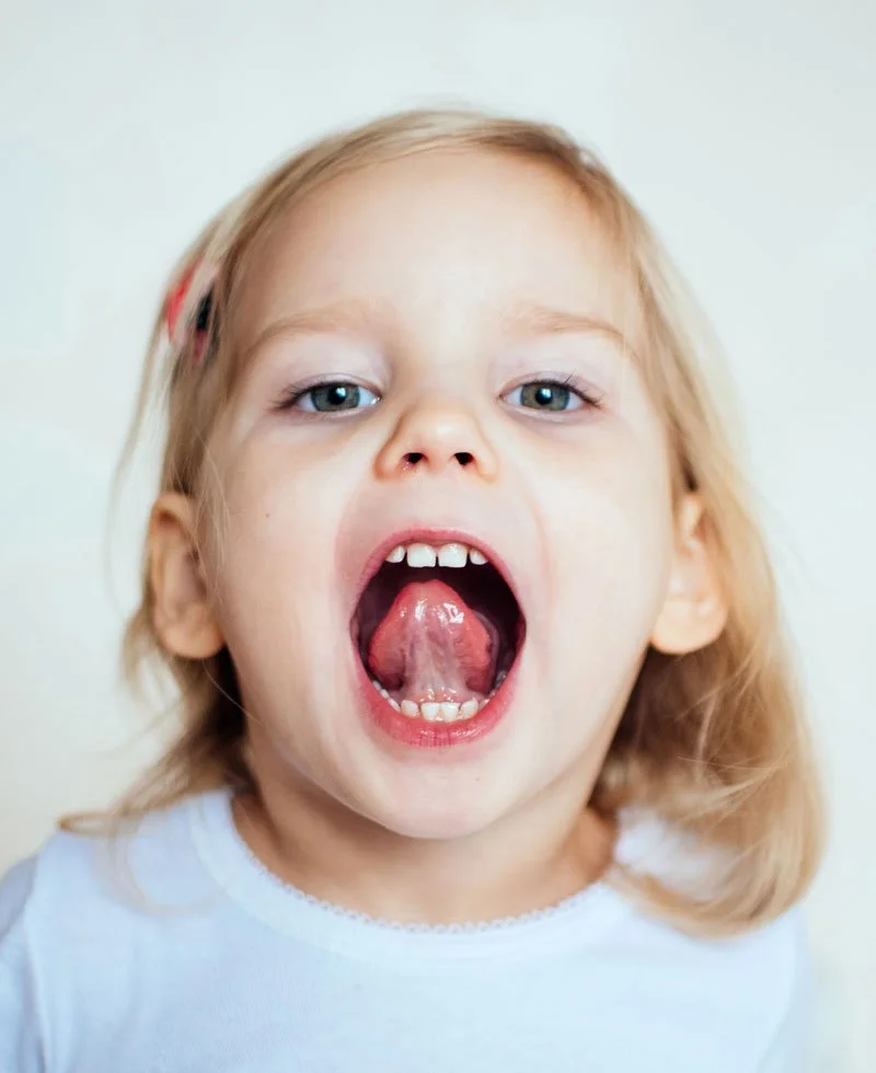 What to Expect Before and After Your Baby’s Tongue-Tie Release