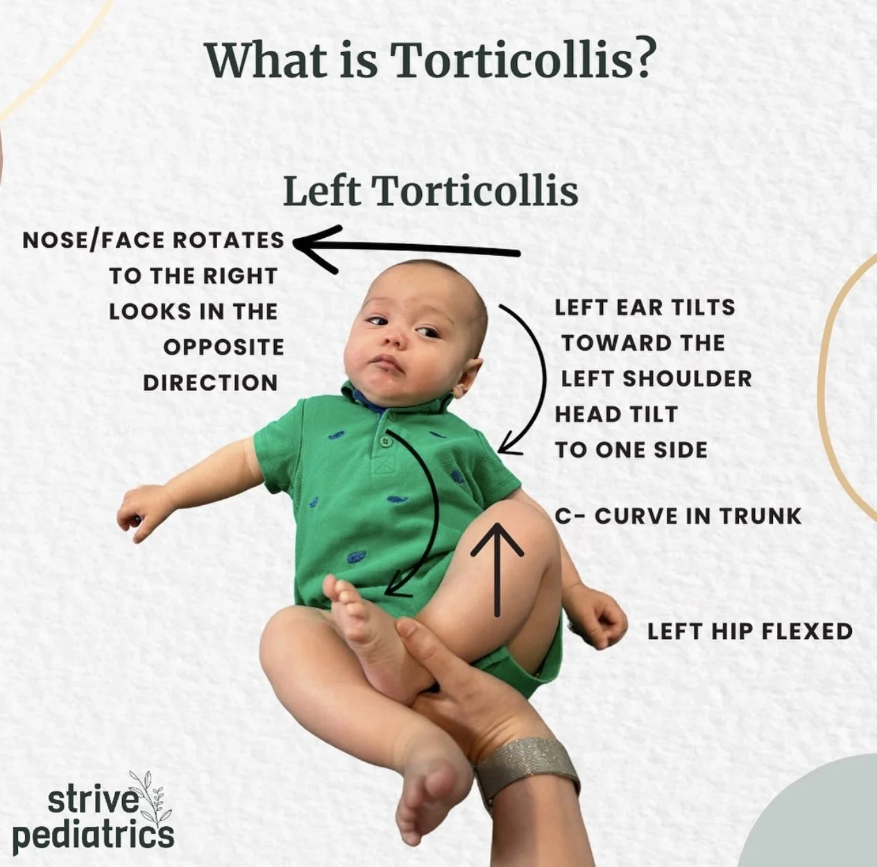 Torticollis in Babies: Signs, Treatment, and Early Therapy — Strive ...