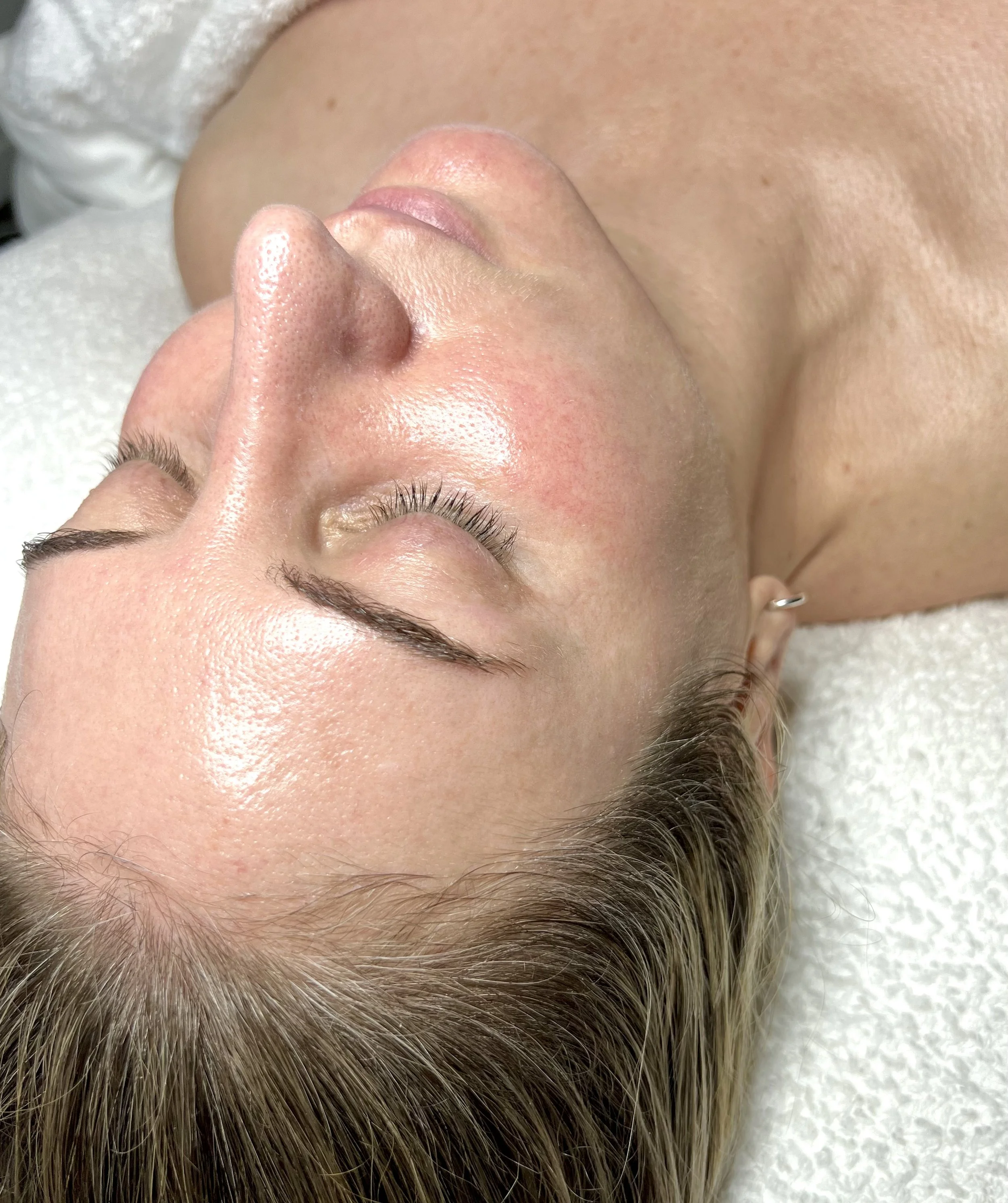 Professional facial treatment at MiSkin Auckland targeting skin health, hydration and texture