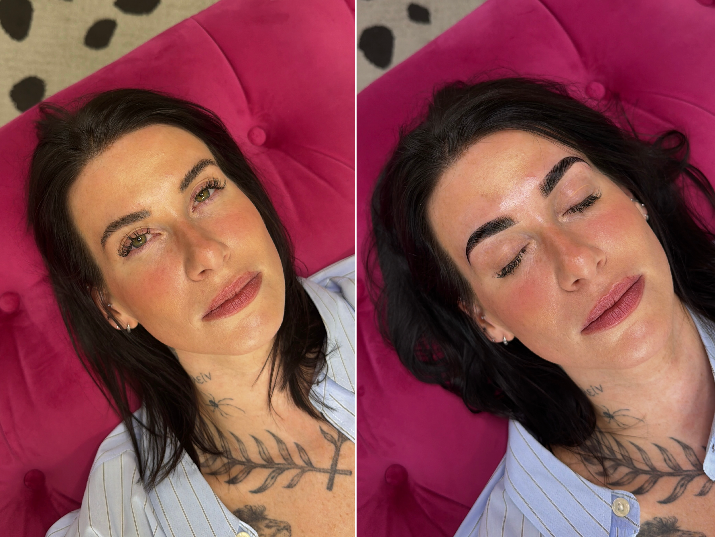 Side-by-side comparison of a woman with dark hair, lying on a pink cushion. The left side shows her face before a cosmetic procedure, and the right side shows her face after. She has tattoos on her chest and is wearing a white shirt with thin stripes.