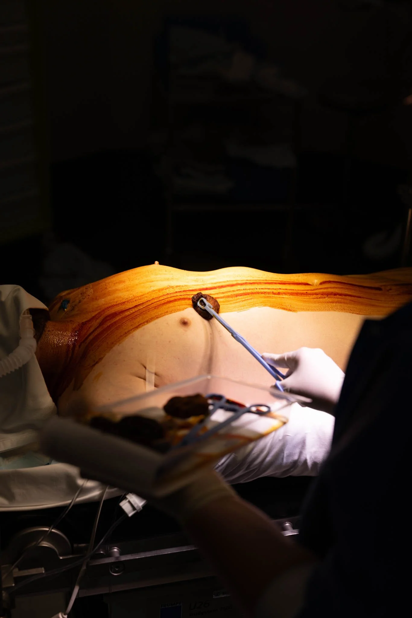 FRANCE-LILLE-ORGAN DONATION-LM-8.jpg