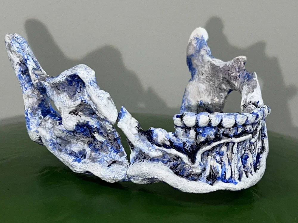 radium jaw 1.webp