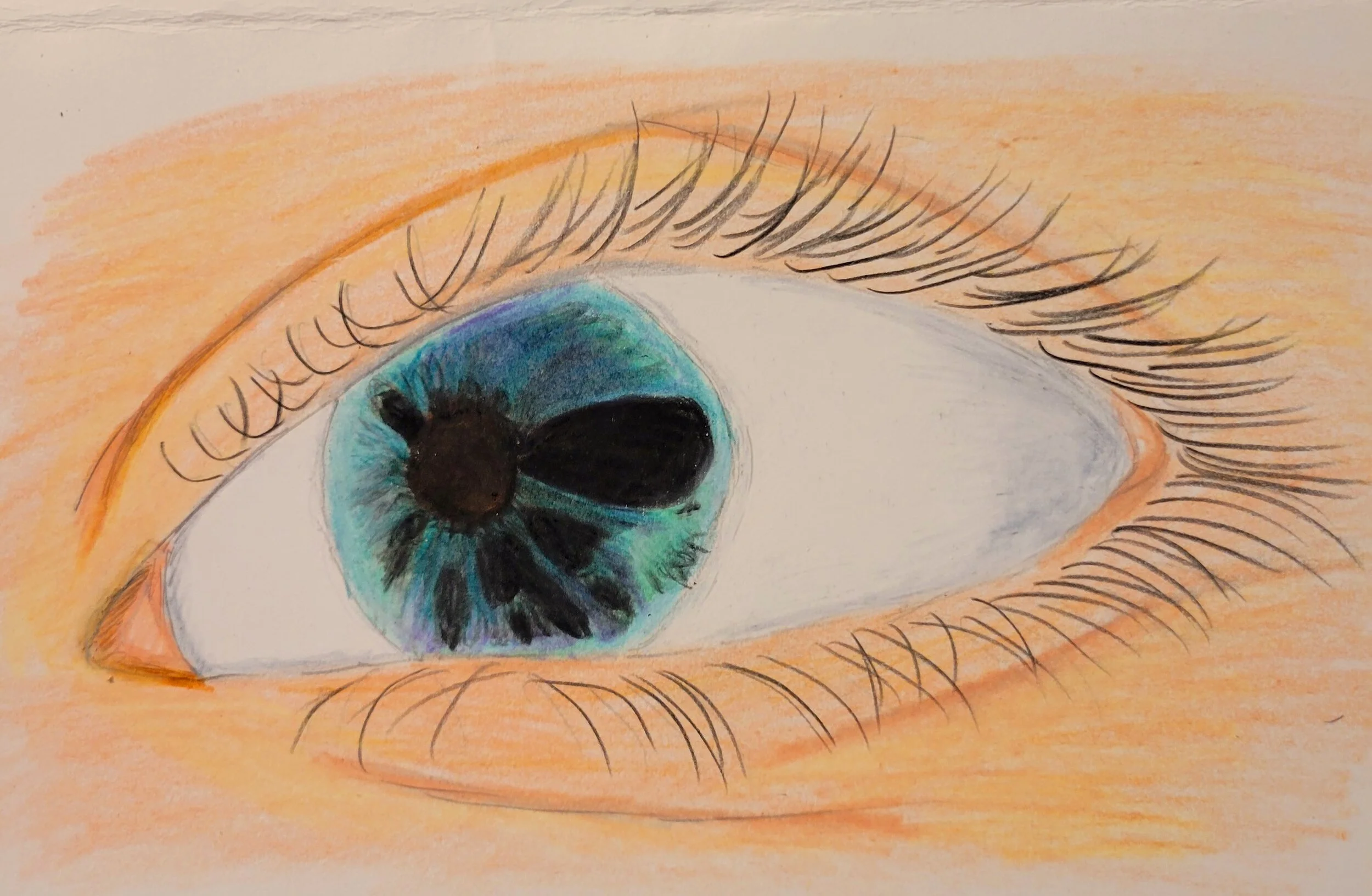 Drawing of my Left Eye - Aniridia 6/18/23