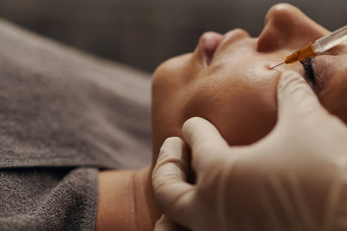 Woman receiving Sculptra injections for facial rejuvenation in Tucson
