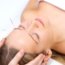 A woman receives a facial acupuncture treatment with her eyes closed, lying down with her head supported by a towel.