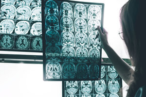 Helping the Fight Against Alzheimer's
