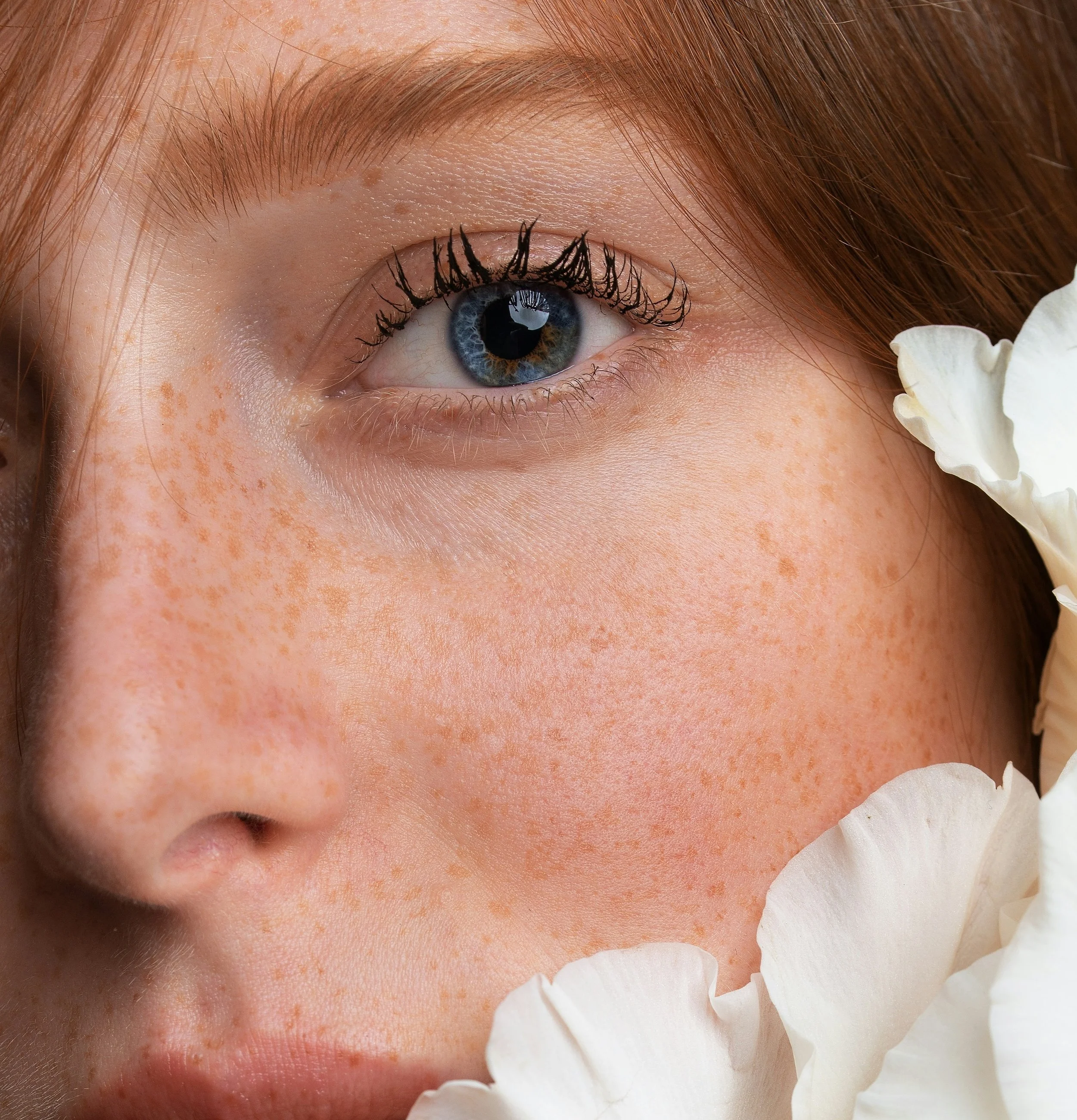 Kestopigmentointi pisamat