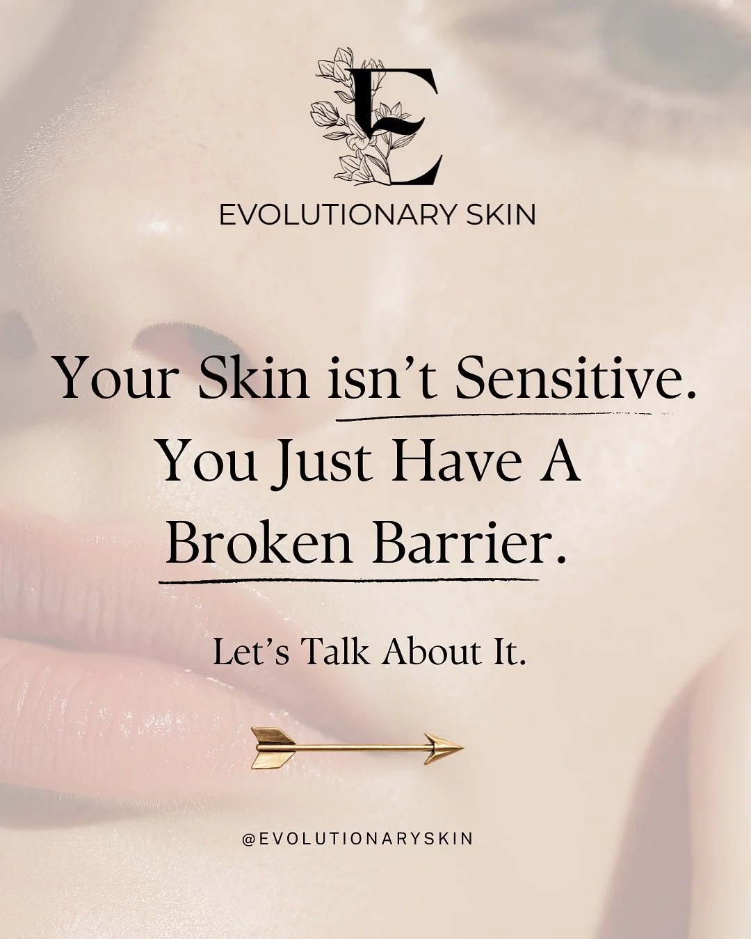 Had fun making this one! A healthy barrier is the foundation of healthy skin &mdash; no matter whether you&rsquo;re struggling with acne, rosacea, aging, sensitivity, or inflammation. When the barrier breaks down, the microbiome becomes unbalanced, i
