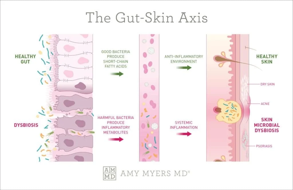 The Skin–Gut Connection: Why Healing Your Skin Starts From the Inside