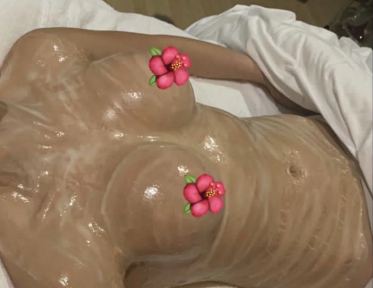 Heal the Skin and Encourage Healing after Cosmetic Breast Enhancement with DMK enzyme therapy in Reseda, CA