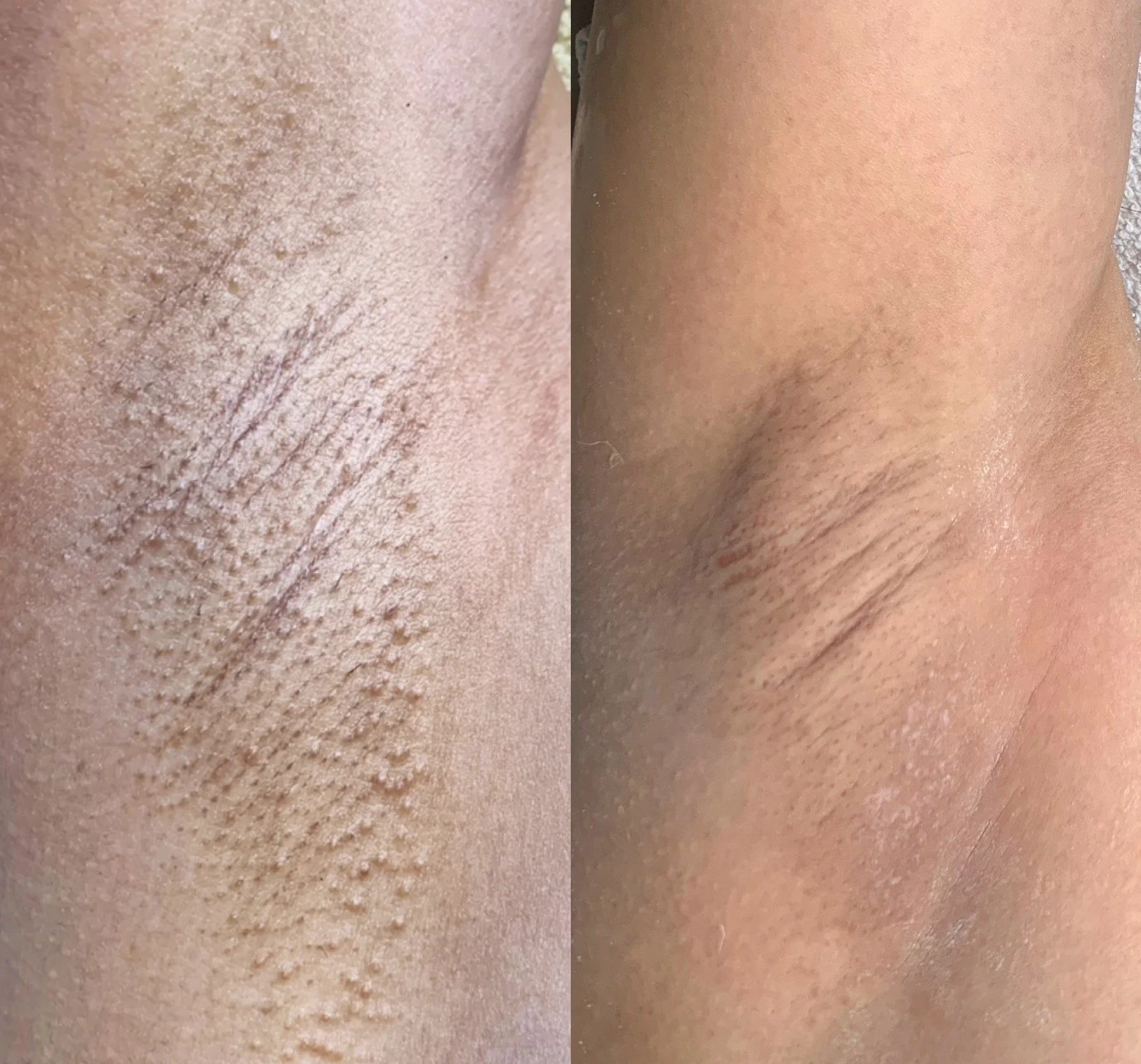 Revise Texture + KP