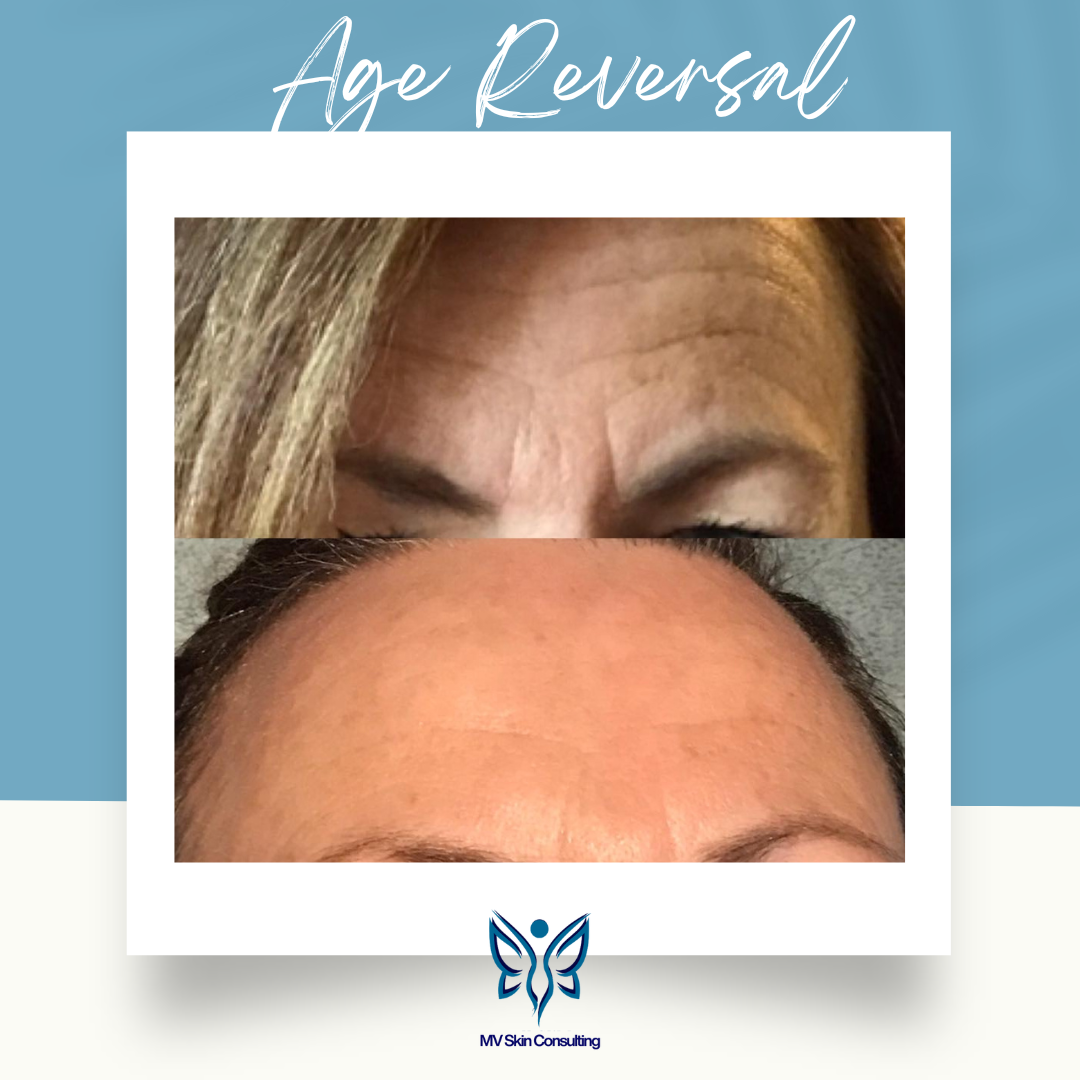 MV Skin Consulting’s anti-aging facials naturally reverse fine lines and wrinkles, helping you look and feel your best, serving the DFW area.