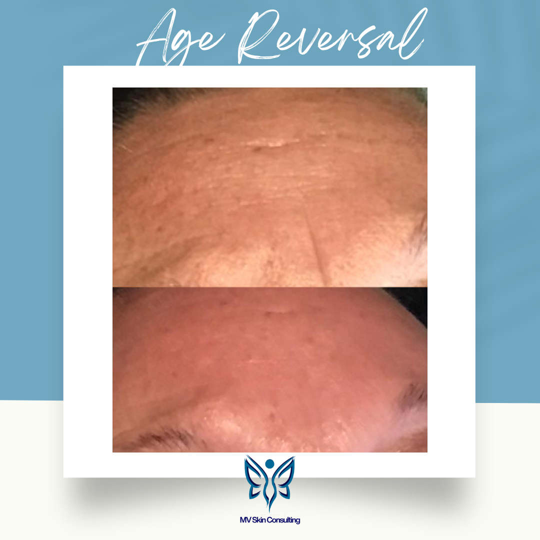 “DFW’s natural solution for lines and wrinkles with MV Skin Consulting’s holistic anti-aging facials delivering visible results.”