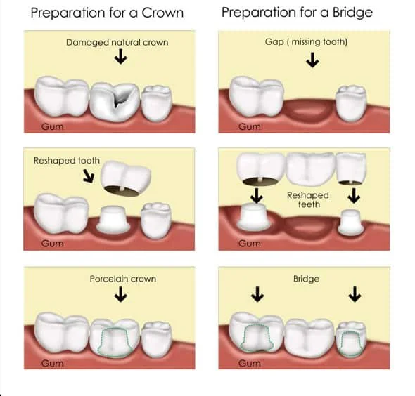 COSMETIC DENTISTRY — GREYSTANES DENTAL