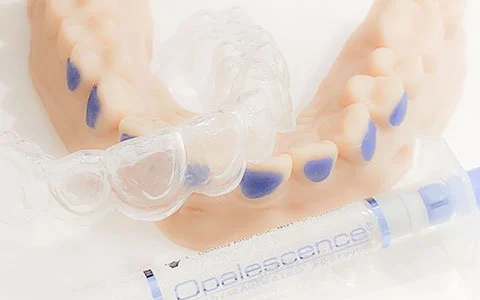 A dental aligner with blue accents, a dental buccal pad with blue markings, and a white Opalescence teeth whitening syringe.