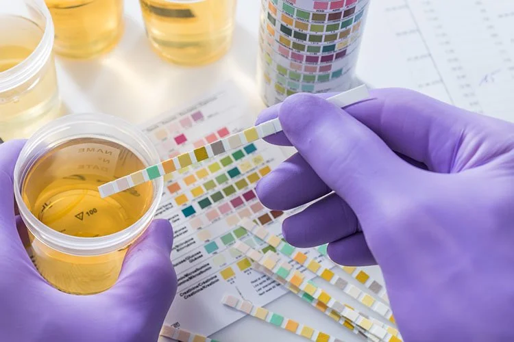 Drug Testing