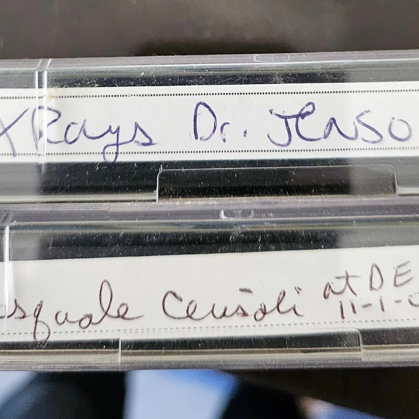 I just found 2 amazing gems on HI-8 video tapes. Dr Clarence Jenson was my Toggle mentor who taught me BJ Palmers Xray analysis and I recorded it and laminated our notes🤩. Also I have Dr Pasquale Cersoli speaking at DE in 2003💪🧠🤩. I need to find 