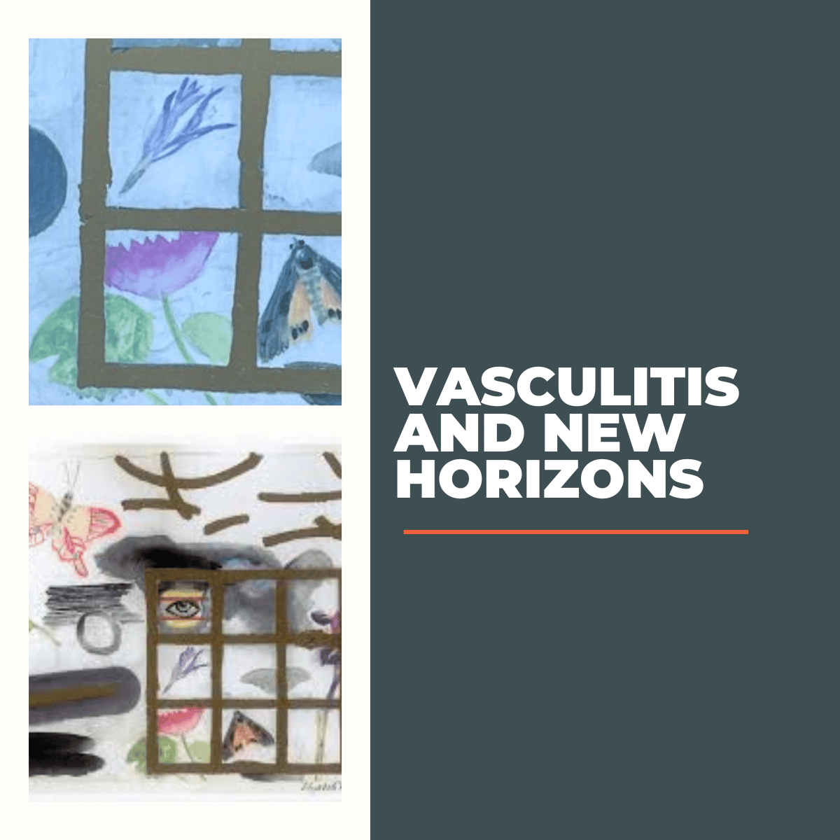 Vasculitis and new horizons