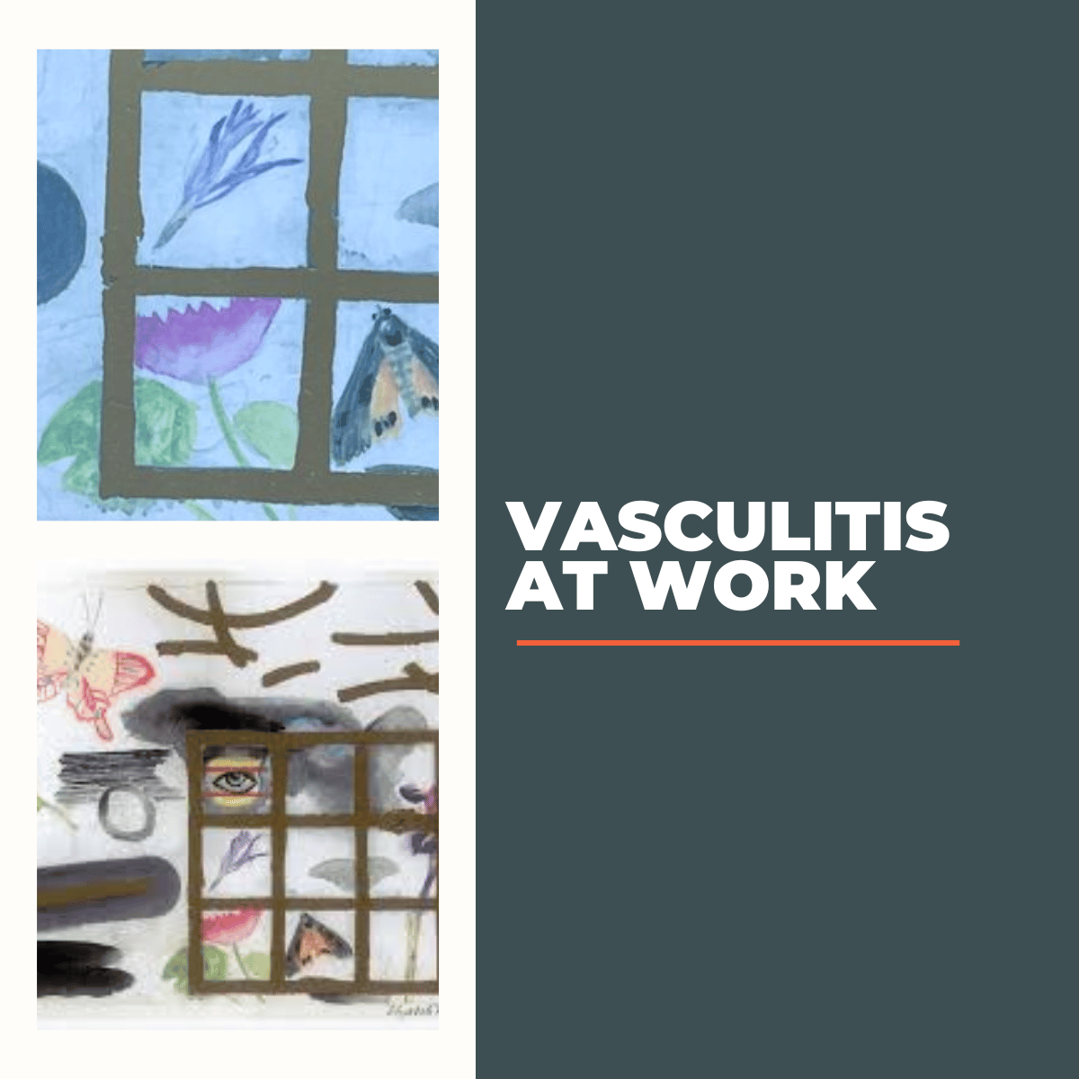 Vasculitis at Work