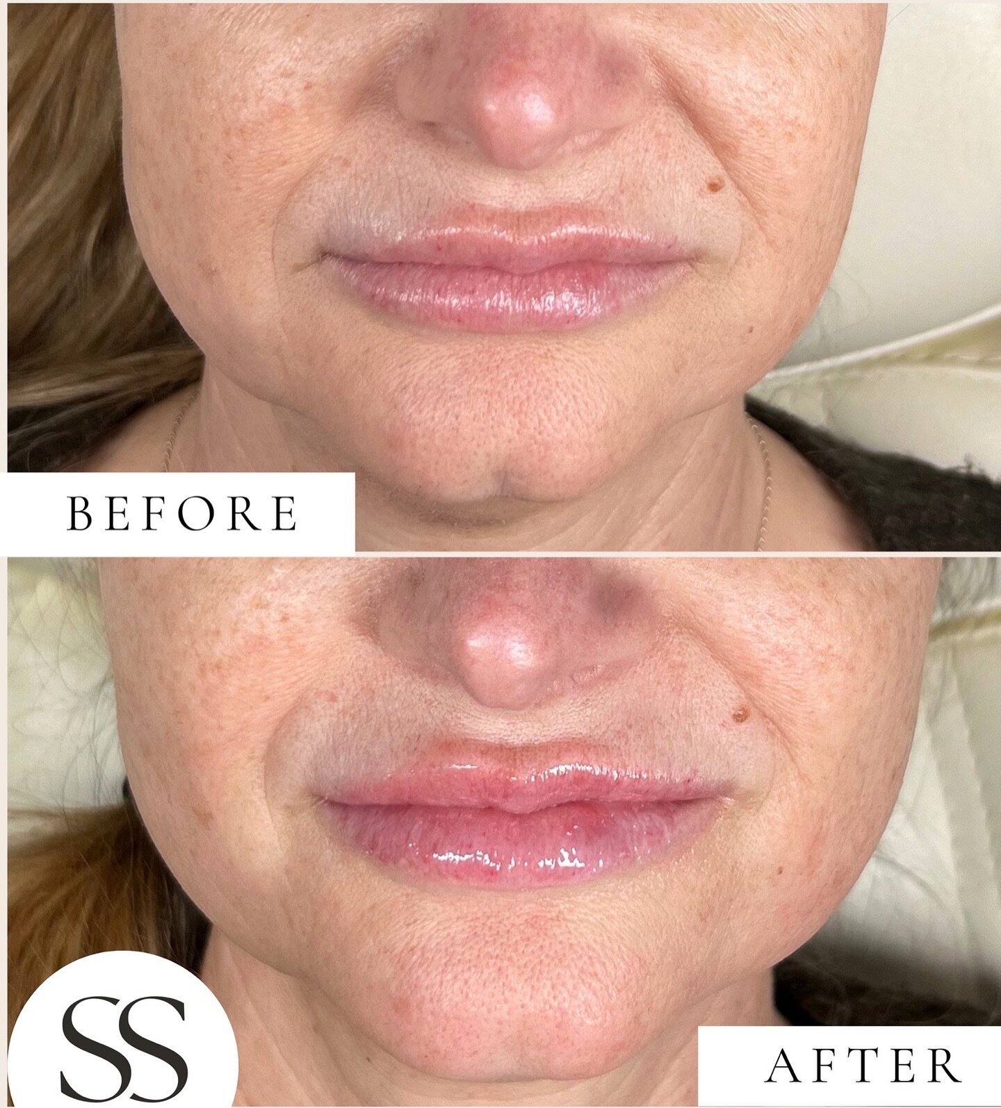 Contact Us Summer Skin Medical contact-us-summer-skin-medical