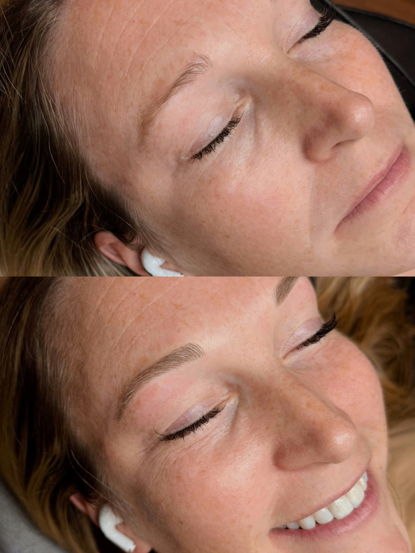 Nothing hits quite like a really good before and after 💥 One session of microblading and these brows are totally transformed. 

| ʙʀᴏᴡꜱ ʙʏ ʟɪꜱᴀ |