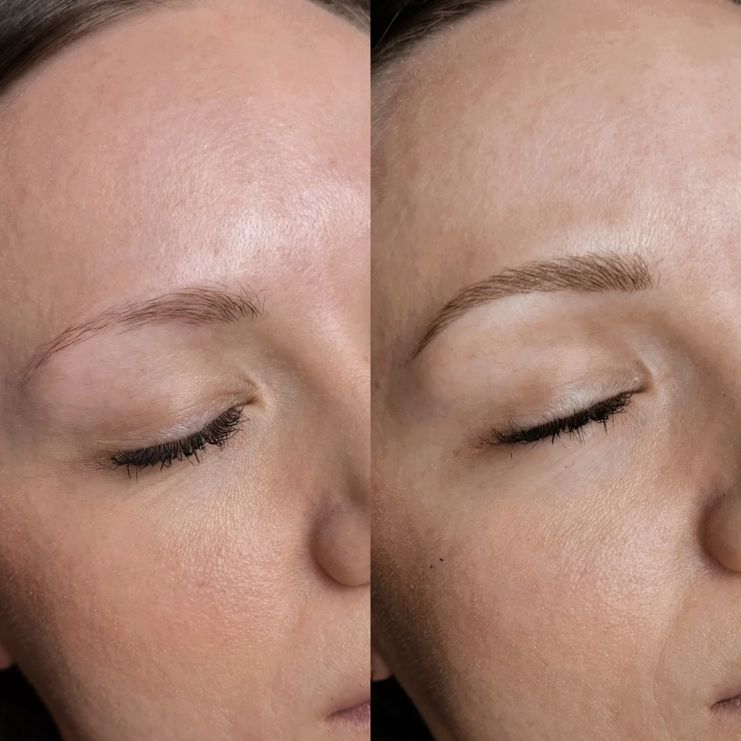 You actually can finally get the perfect brow shape. And with zero effort on your end 💁🏻&zwj;♀️ 

| ᴍɪᴄʀᴏʙʟᴀᴅɪɴɢ ʙʏ ᴀʟʟʏ |