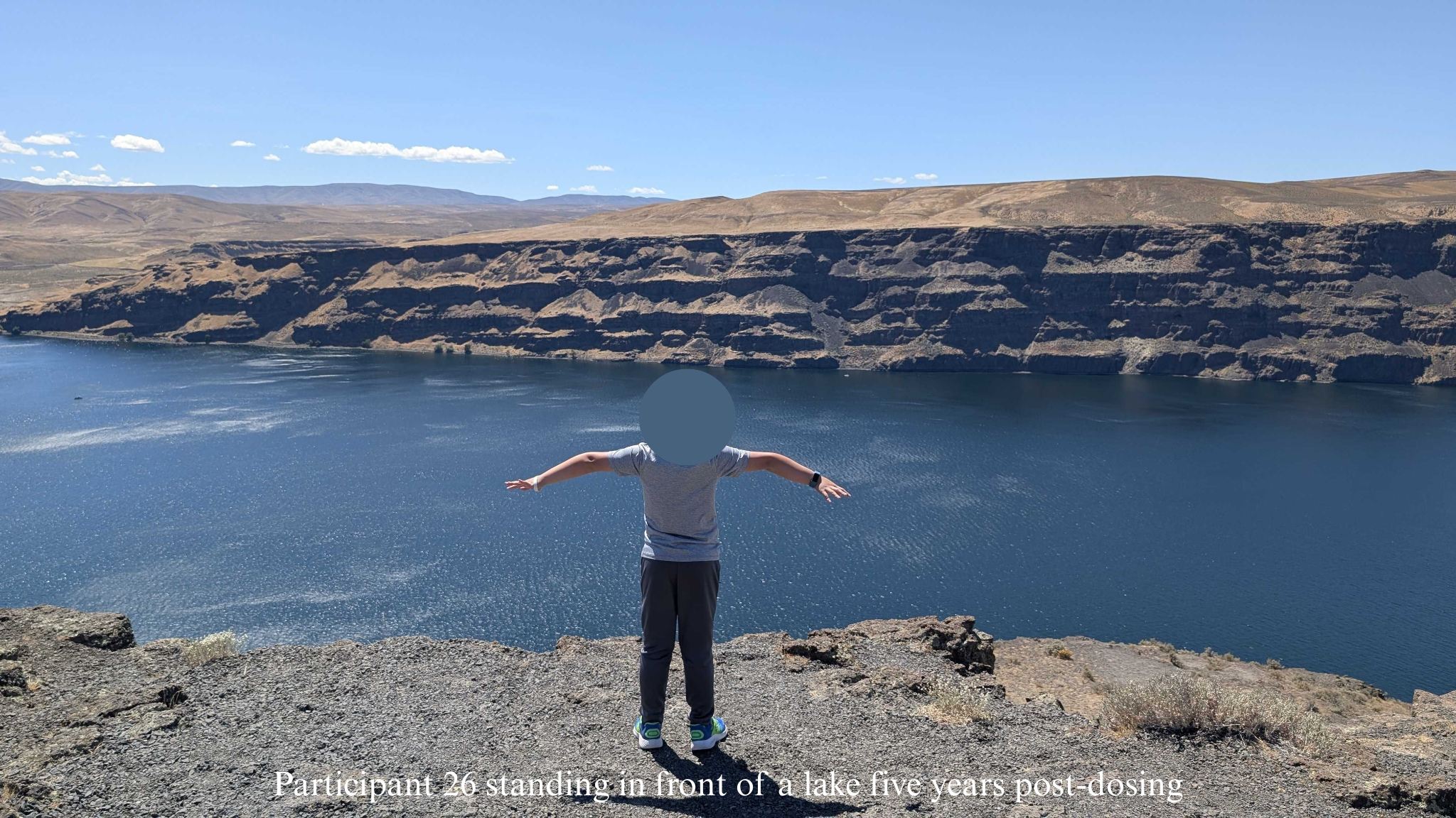 Participant 26 standing in front of a lake 5 years post-dosing