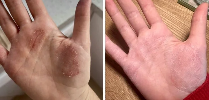 I would love to see your before &amp; after pictures. 