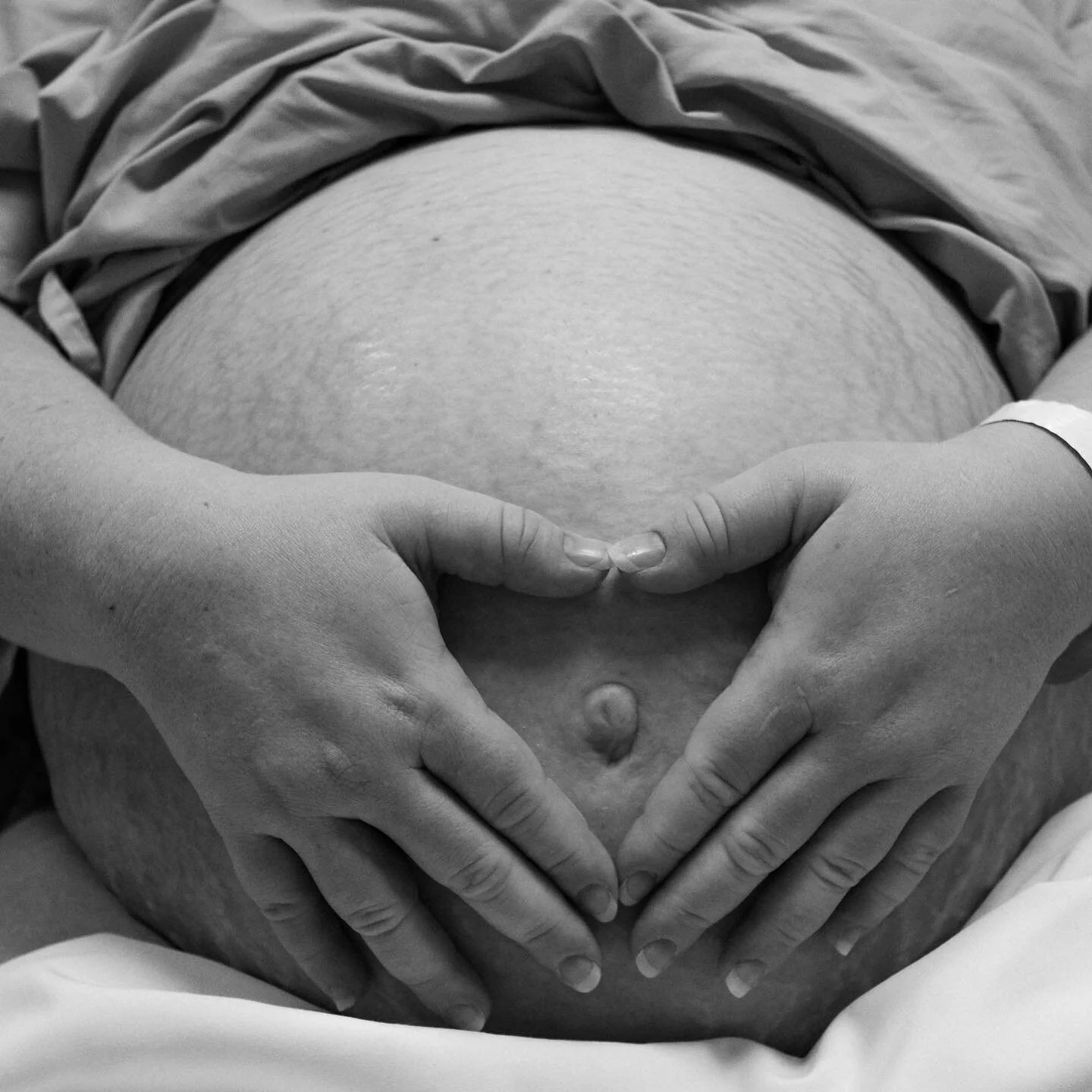 April is the month we pause to honour and celebrate the remarkable women who have experienced a caesarean birth. Their resilience and strength - often during an unexpected turn of events - exemplify the power and beauty of motherhood. 

Through selfl