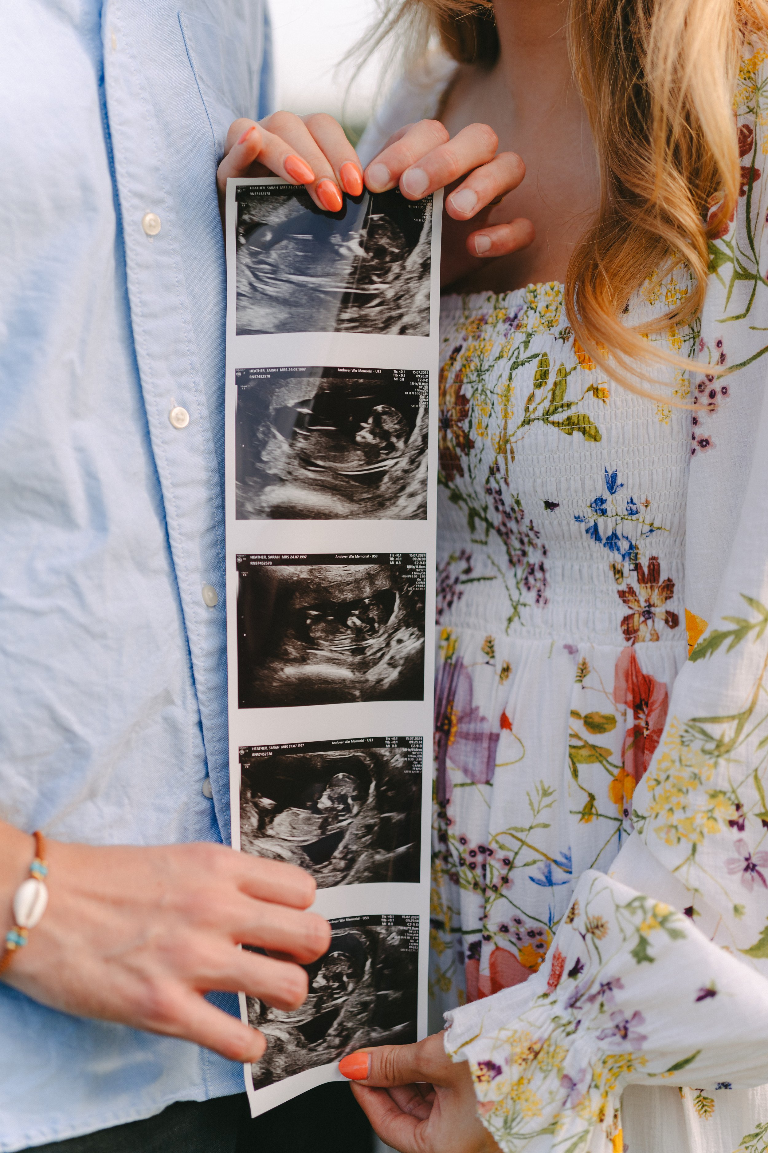 A couple holding ultrasound images of a fetus during a pregnancy, with the woman wearing a floral dress and the man wearing a light blue shirt.