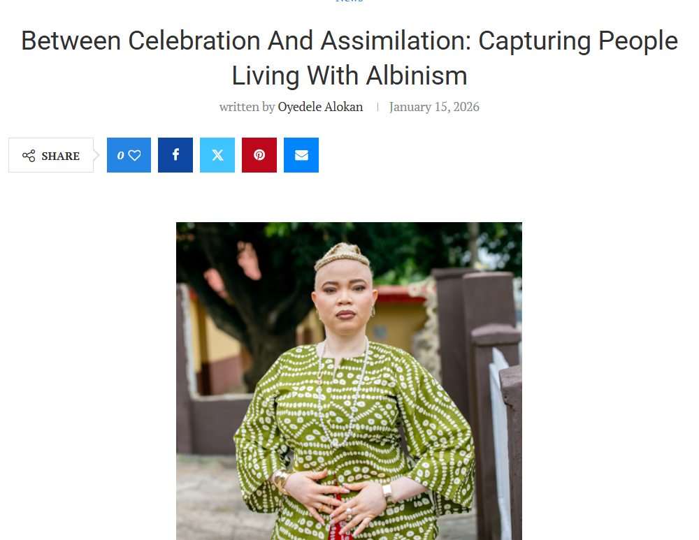 Aderopo Afolabi work on Women Living with Albinism