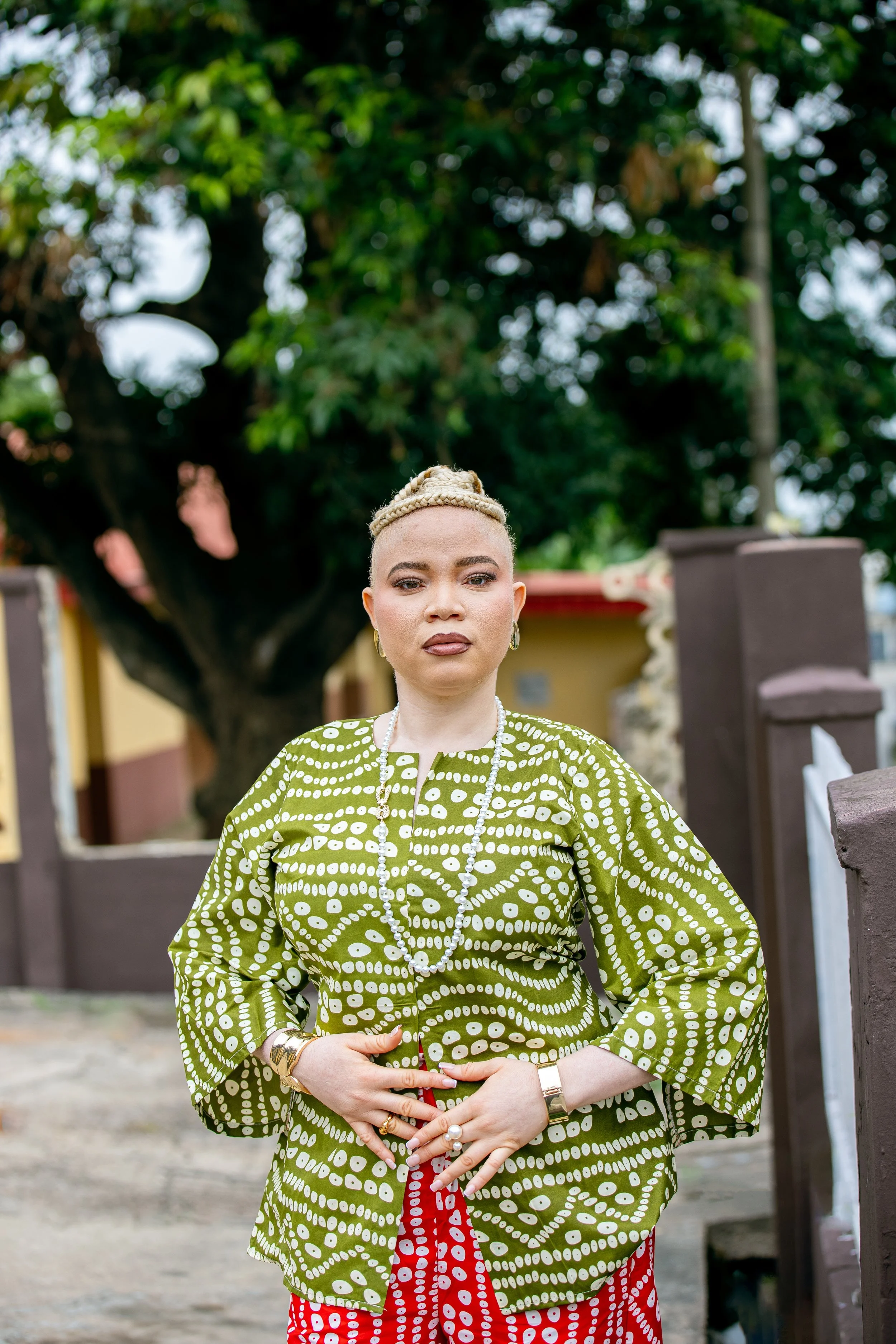 ALBINISM. ADEROPO AFOLABI. PHOTOGRAPHY. 2025 (4).jpg