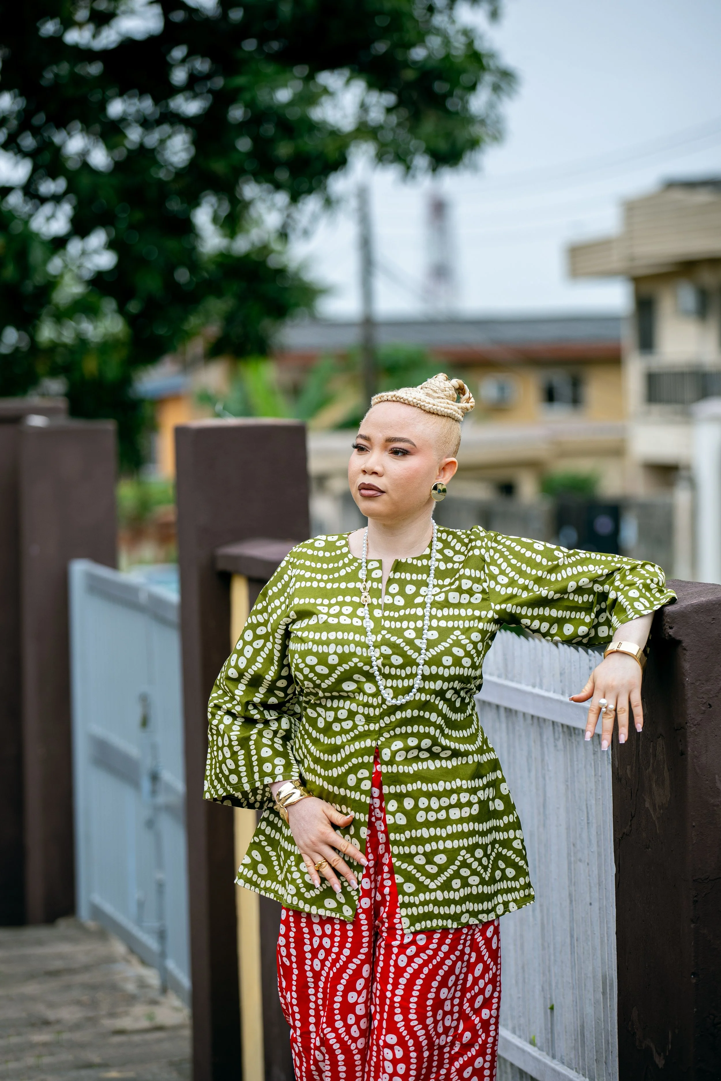 ALBINISM. ADEROPO AFOLABI. PHOTOGRAPHY. 2025 (1).jpg