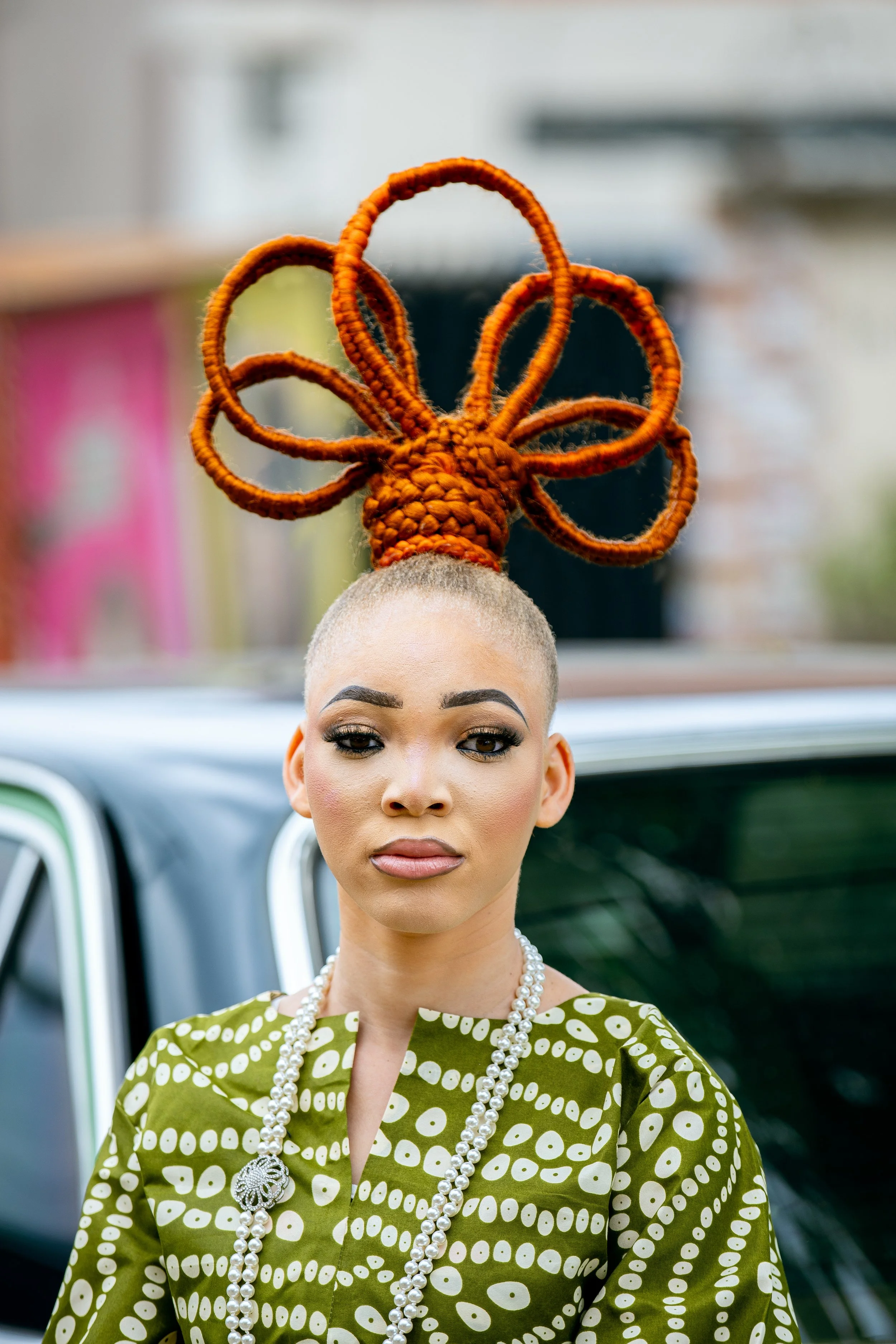 Women Living With Albinism